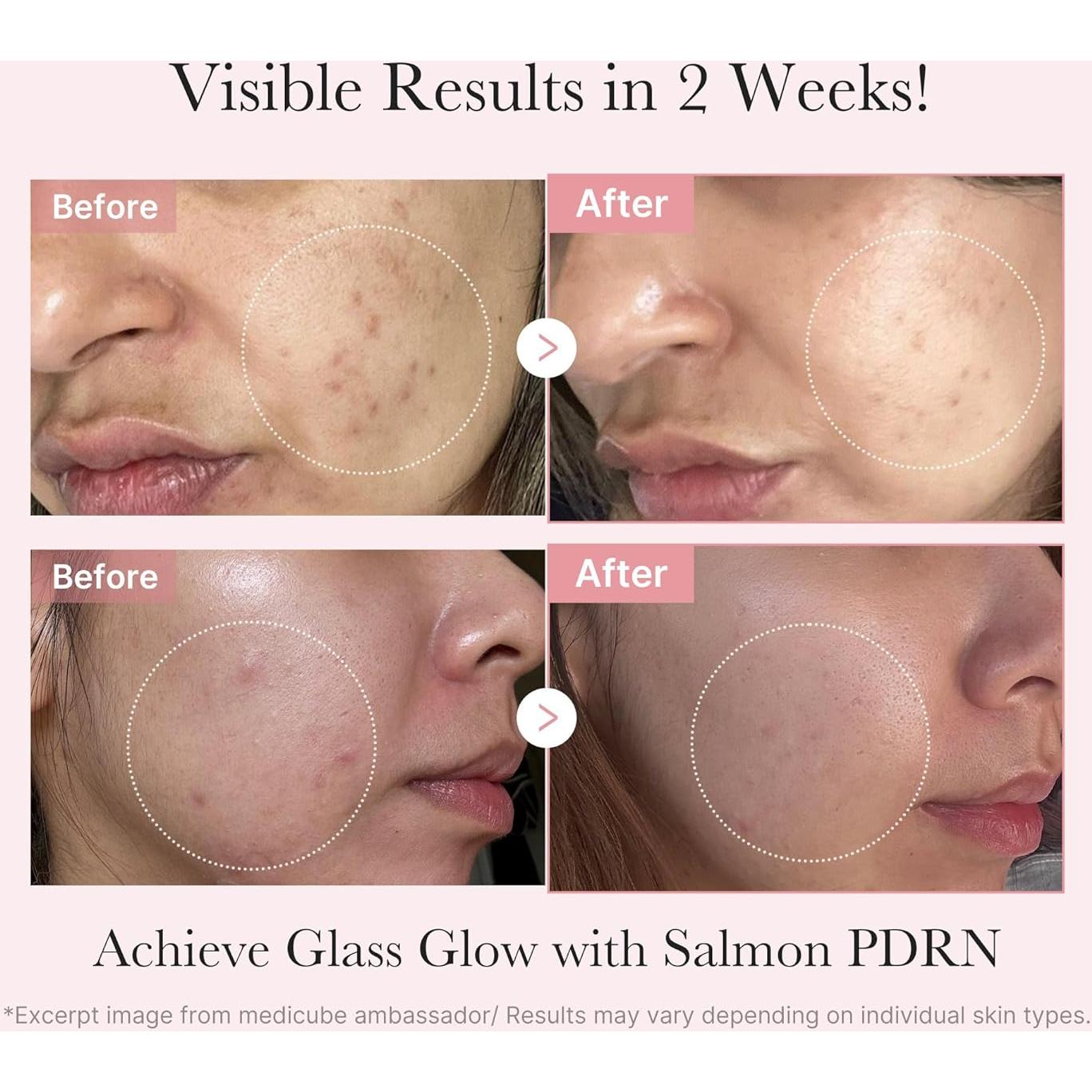 Kit de Cuidado de Piel PDRN Medicube - Tónico, Suero y Mascarilla