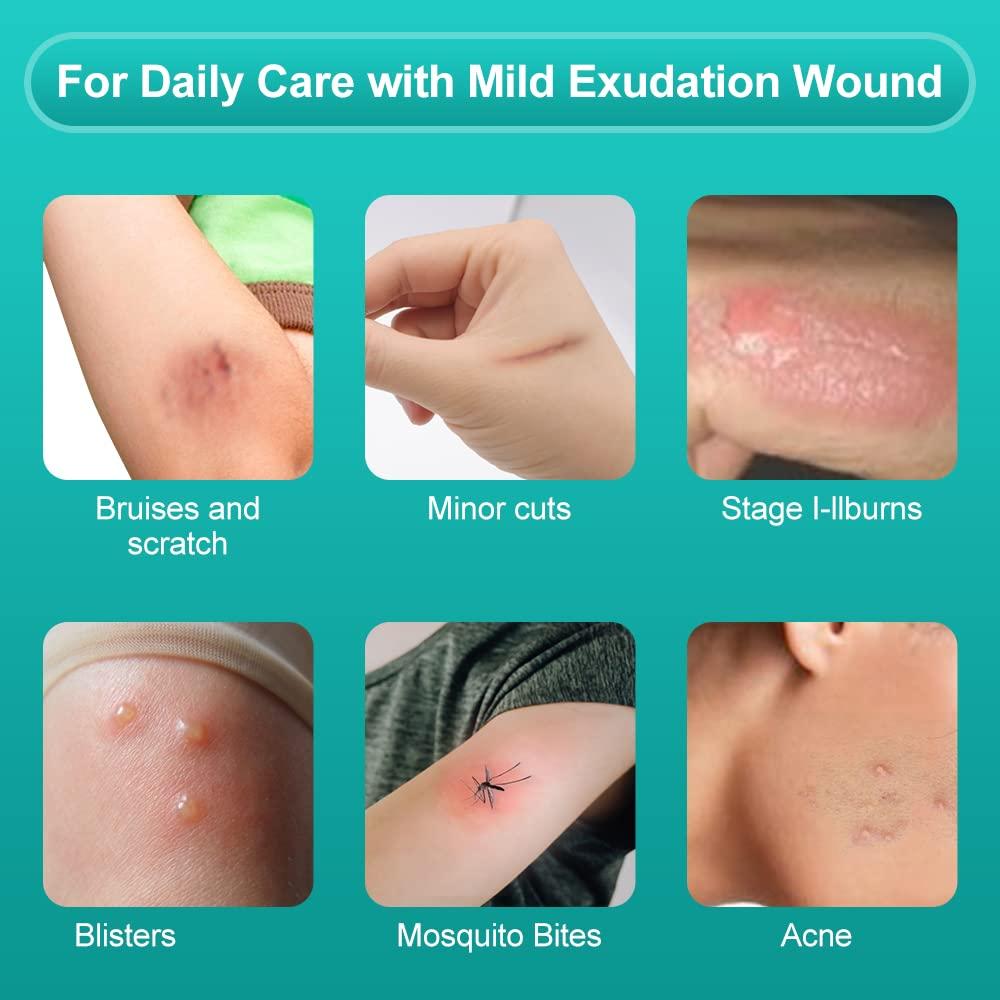 Vendaje Hidrocoloide Dimora 10 Piezas 10x10 cm Estéril