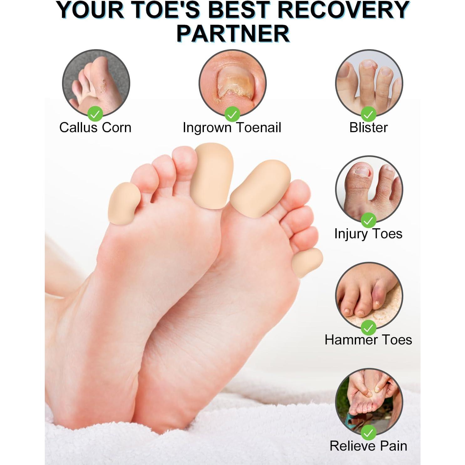 6 Capuchones Protectores de Dedos de Gel DLMDLM - Beige Pequeño