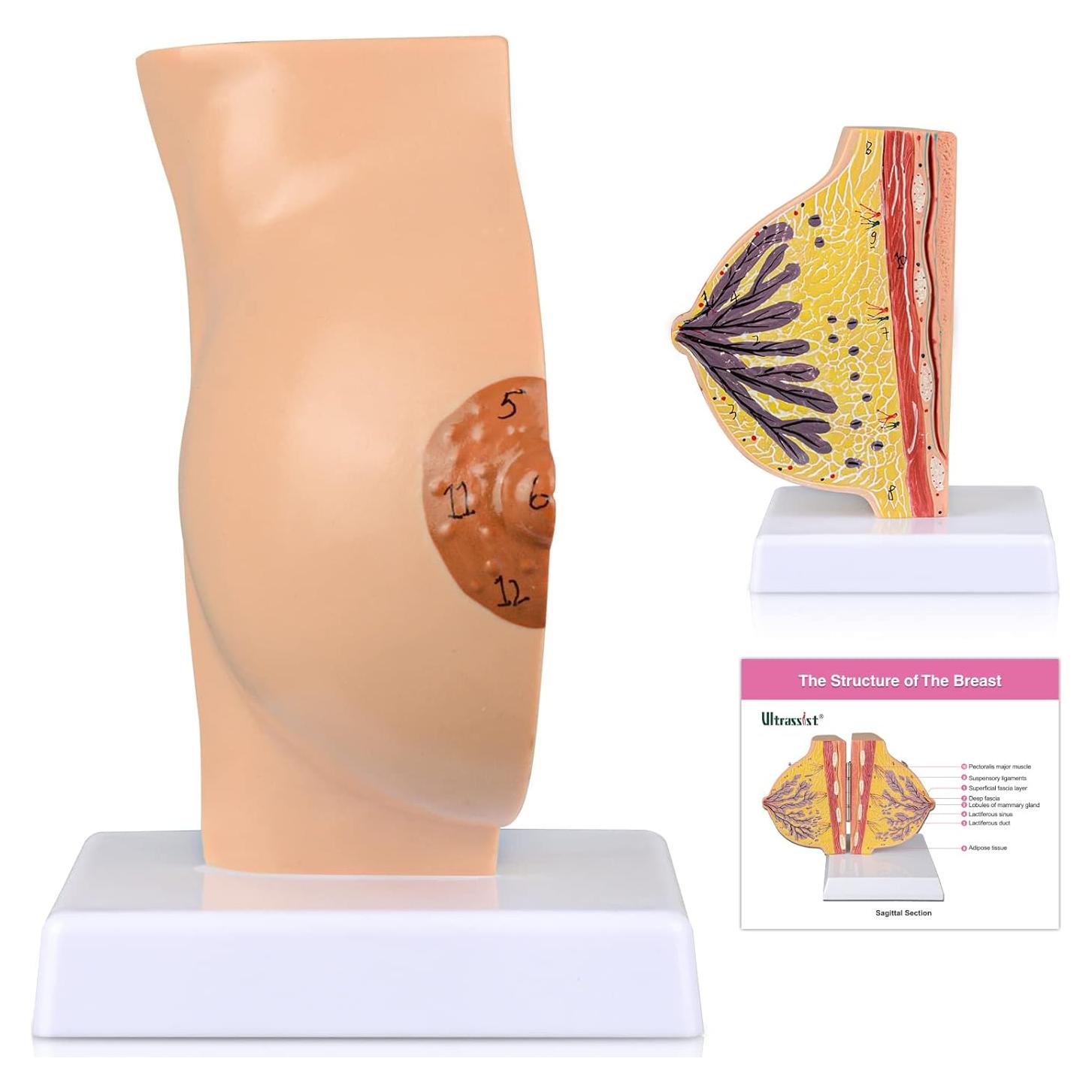 Modelo Anatómico de Mama No Lactante Ultrassist con Tarjeta de Estudio