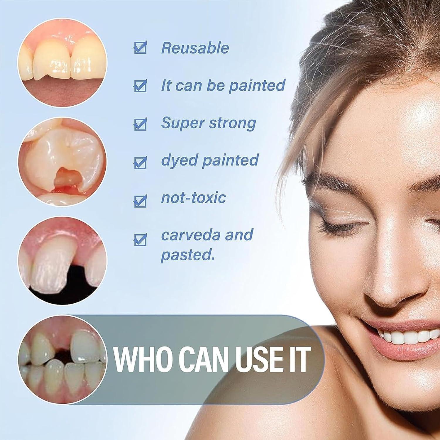 Cemento de Óxido de Zinc Eugenol Genérico - Kit Relleno Dental