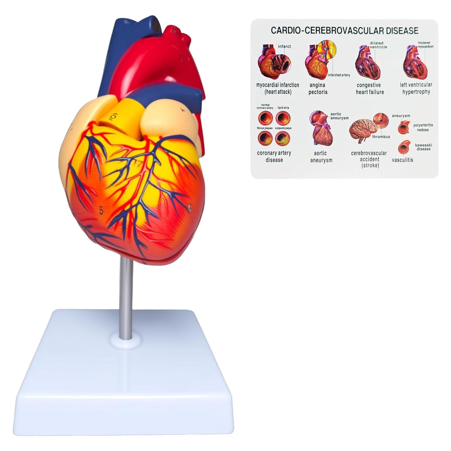 Modelo Anatómico de Corazón Humano Rkakneecs 2 Partes 34 Estructuras