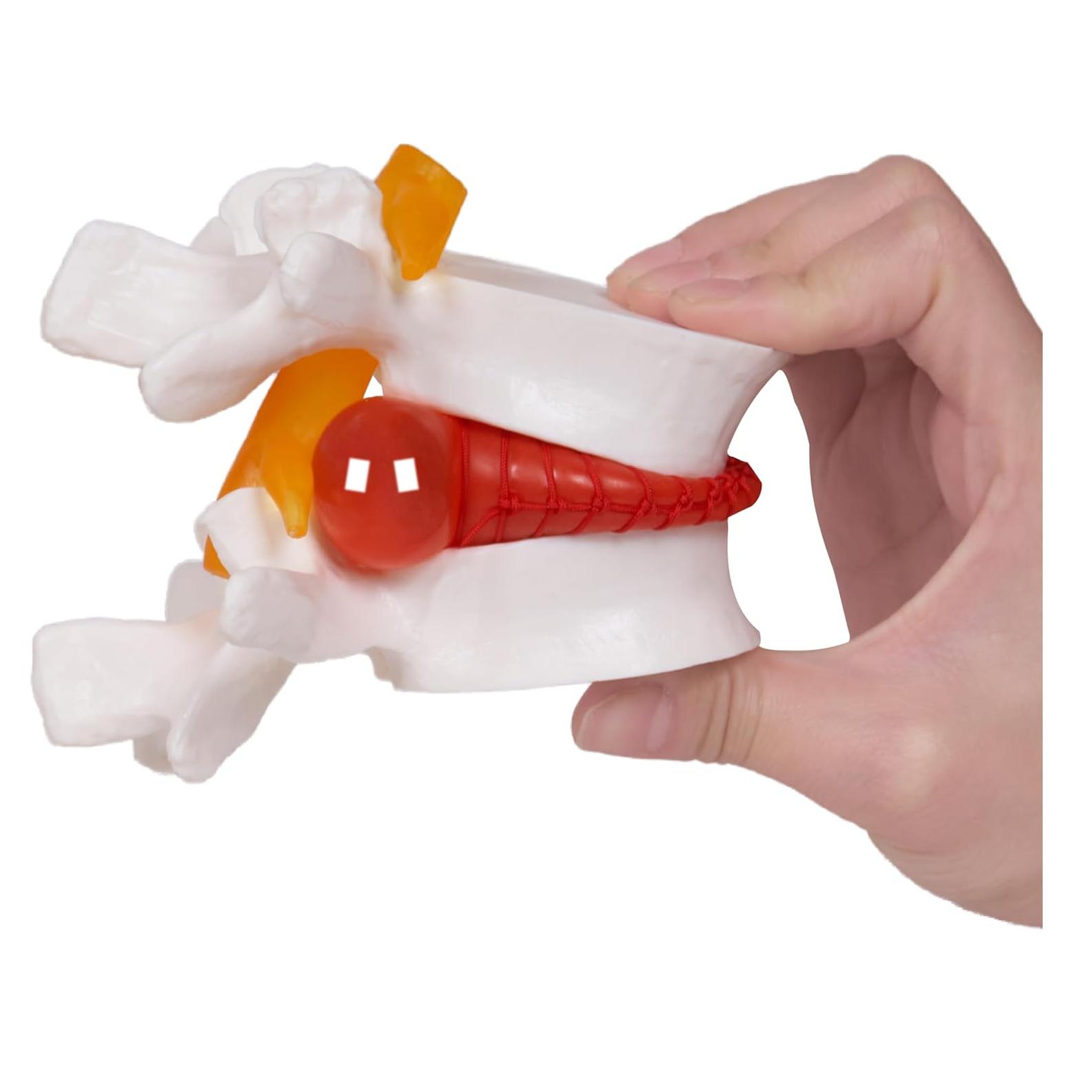 Modelo de Hernia de Disco Lumbar Breesky 1.5x Detalle