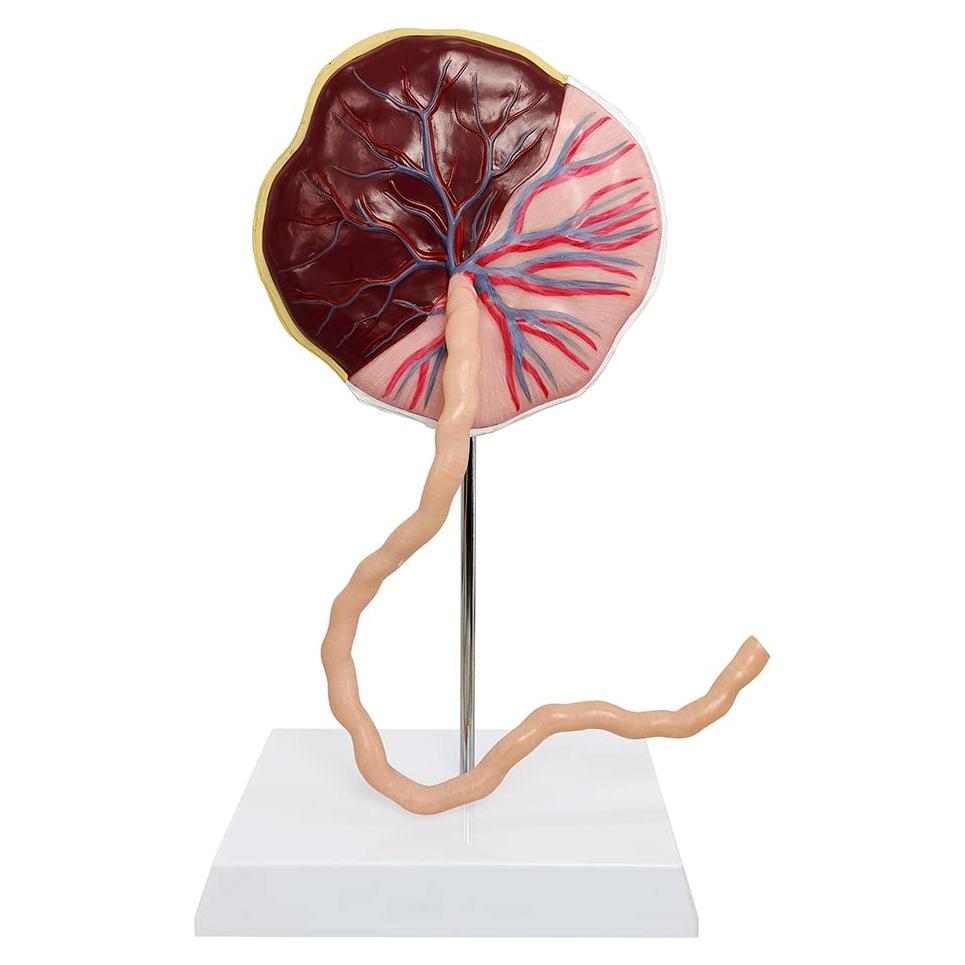 Modelo Anatómico de Placenta Benilev con Cordón Umbilical