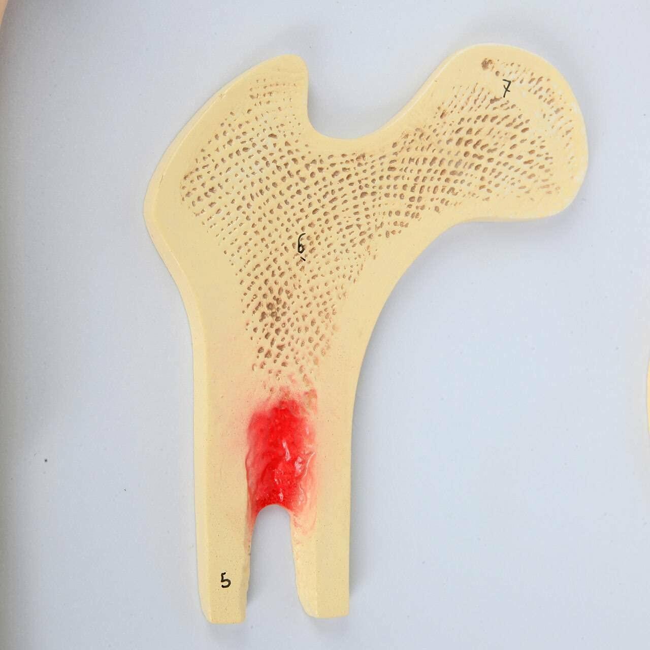 Modelo Estructura Ósea Humana Axis Scientific A-109186 42x30cm