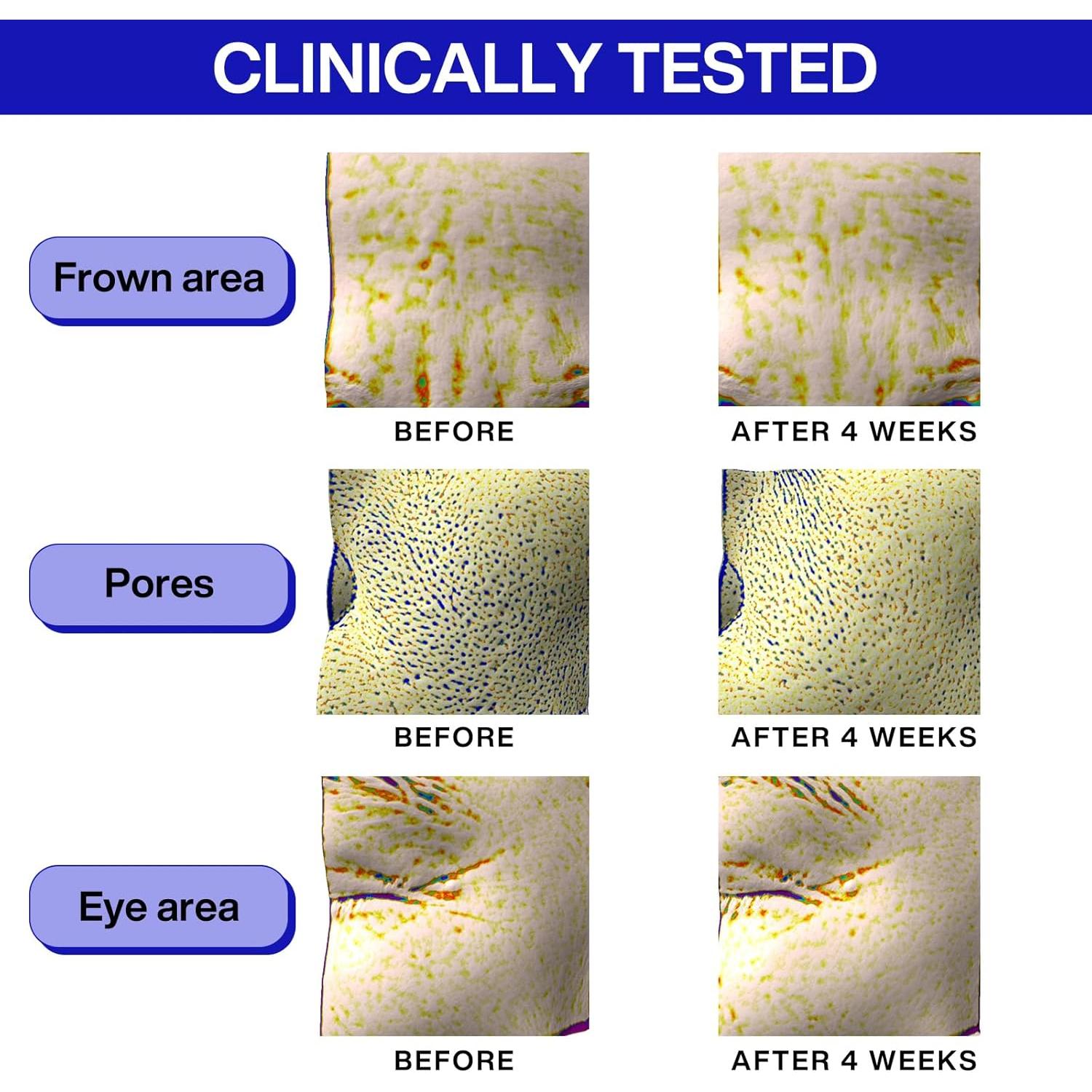 Suero Super Bounce Retinol IOPE 30ml y 50ml - Antiarrugas