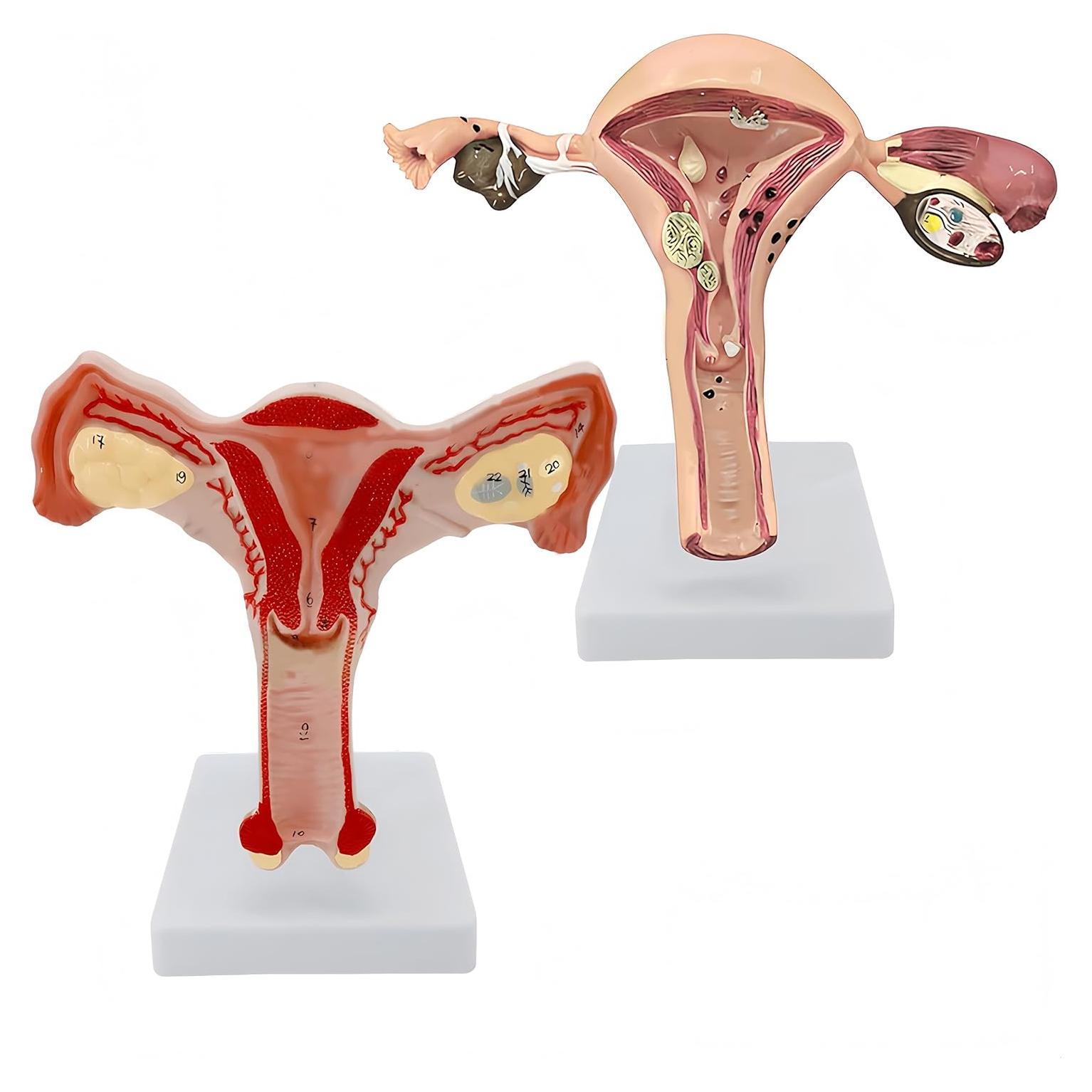Modelo Anatómico de Útero y Ovarios DRXRD 2 Piezas Realista