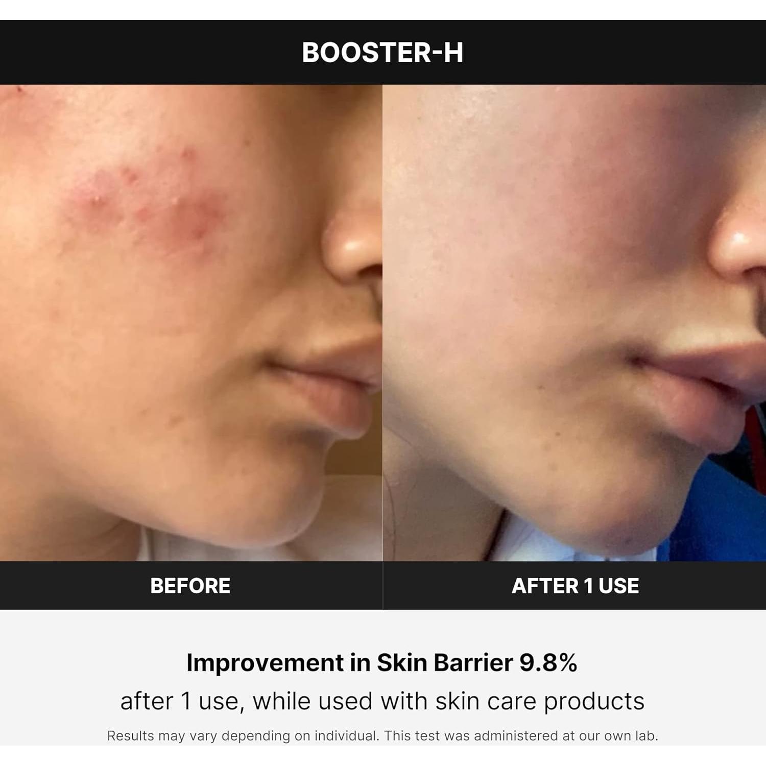 Medicube Age-R Booster H - Acelerador de Brillo Facial