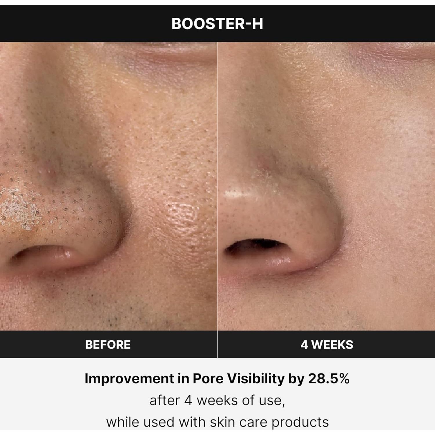 Medicube Age-R Booster H - Acelerador de Brillo Facial