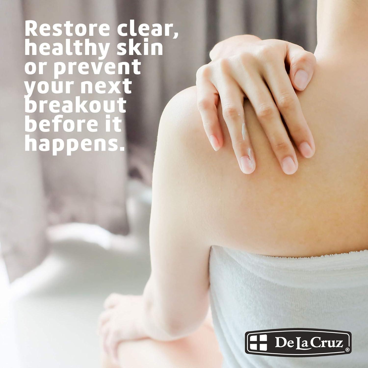 Ungüento de Azufre 5% De La Cruz 30 g - Tratamiento Acné