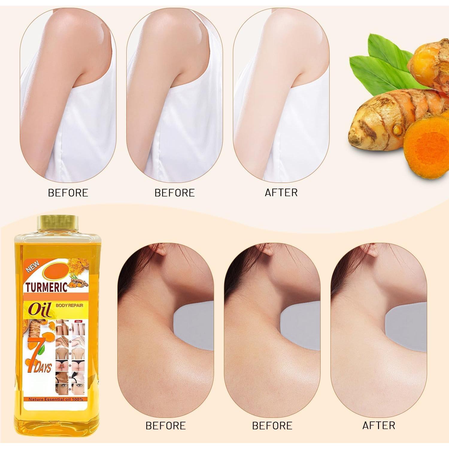 Set de Aceite y Jabón de Cúrcuma Orgánico 200ml - Hidratación y Antienvejecimiento