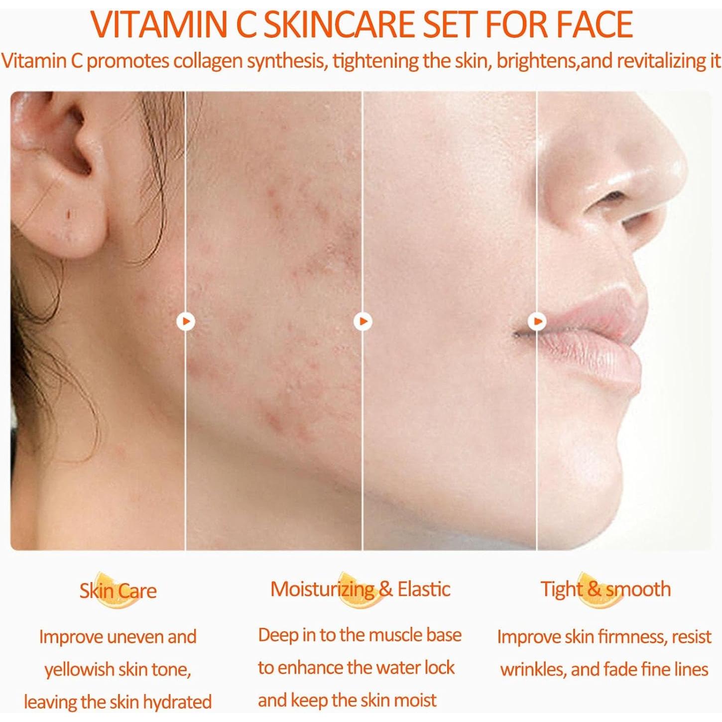 Set de Cuidado de la Piel Rosarden con Vitamina C - 5 Piezas