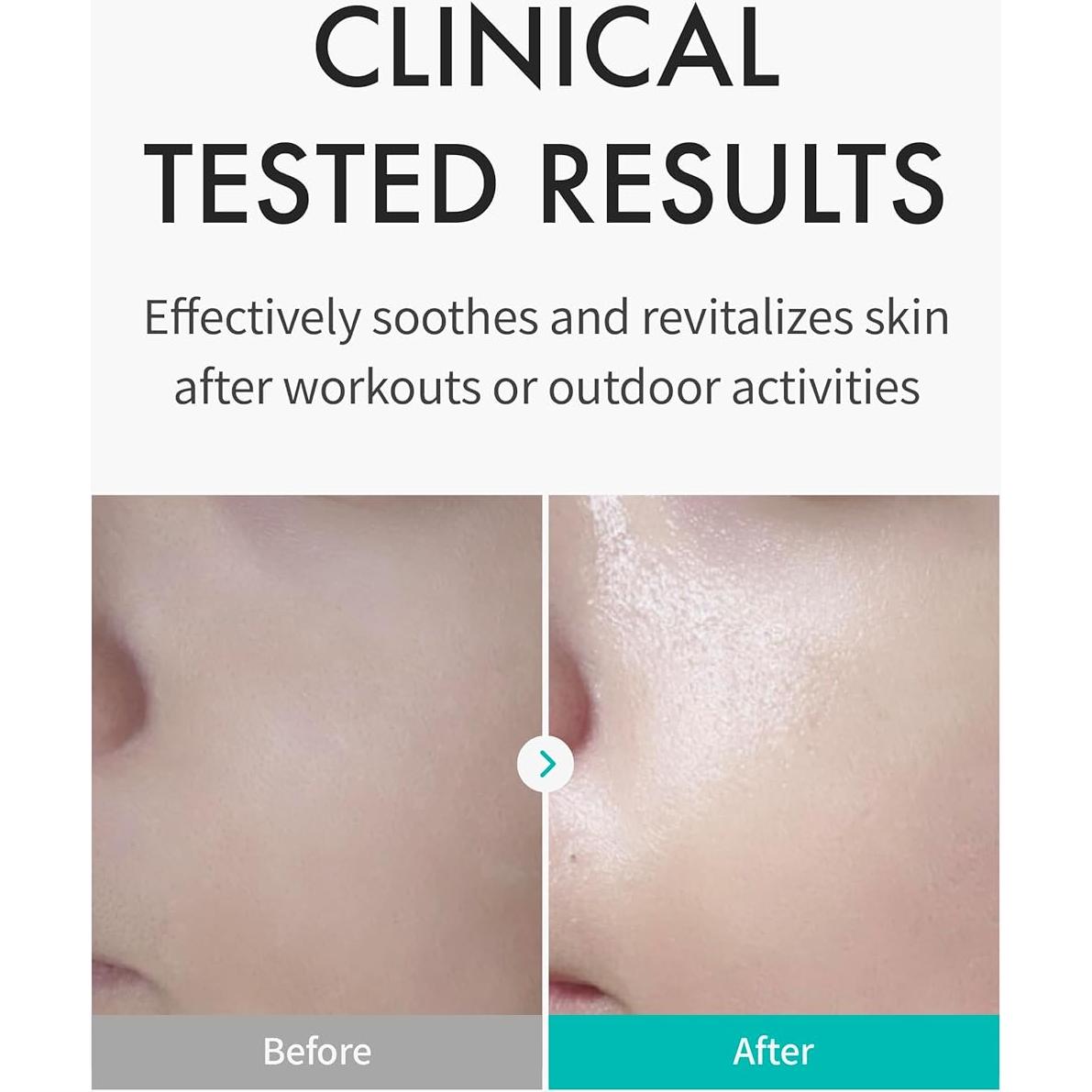 REJURAN c-PDRN Ampoule 30 ml + Mascarilla Hidratante 5-Pack