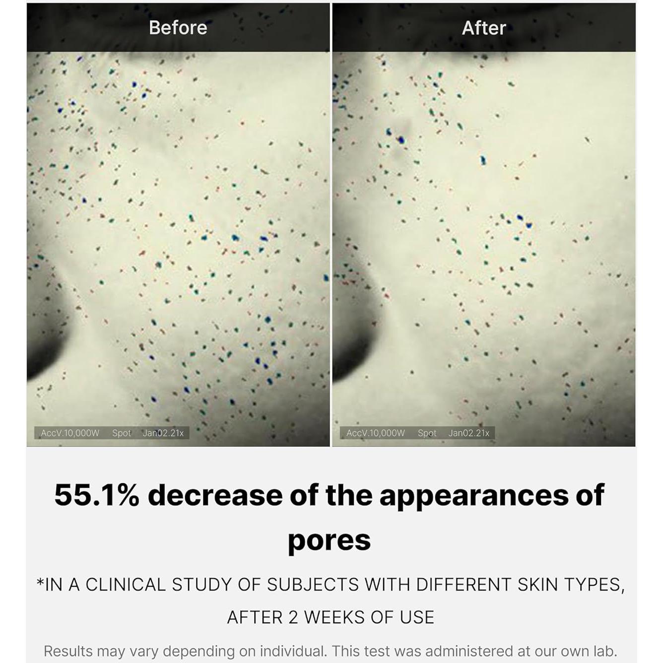 Medicube Zero Pore Crema Refinadora 49.8 ml - Controla Aceite