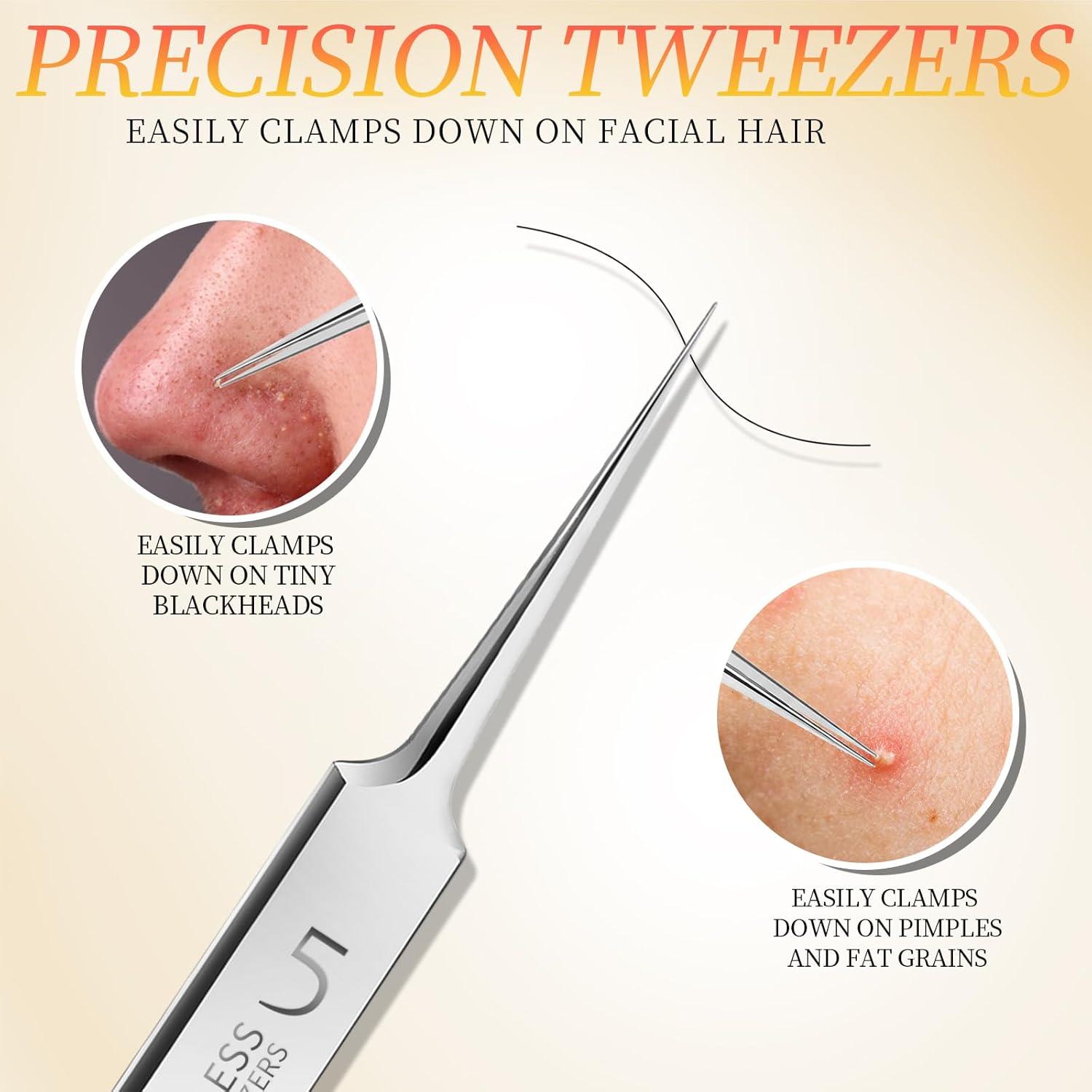 Kit de Herramientas para Extracción de Puntos Negros Teenitor