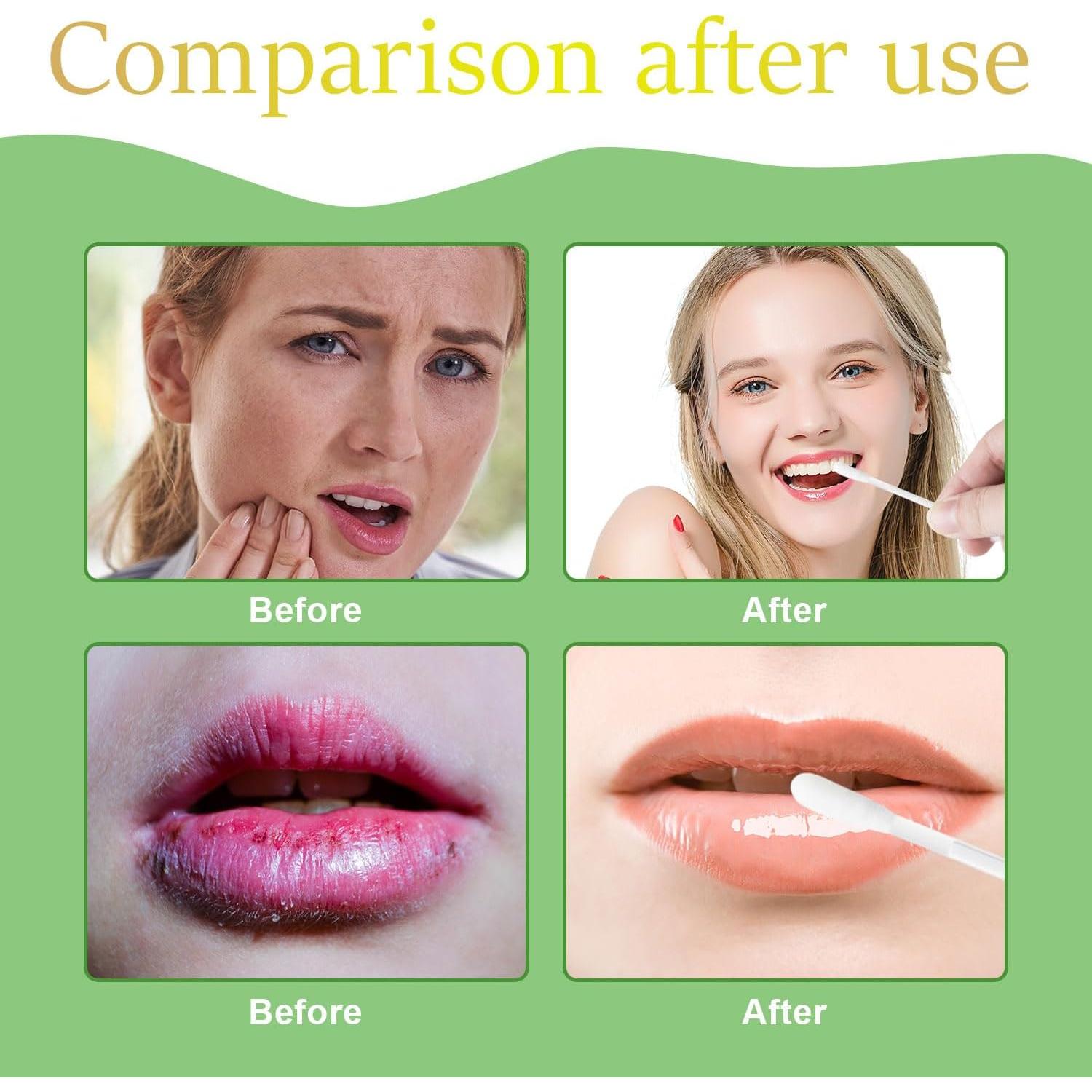 100 Bastones de Algodón Desechables Fenshine para Labios