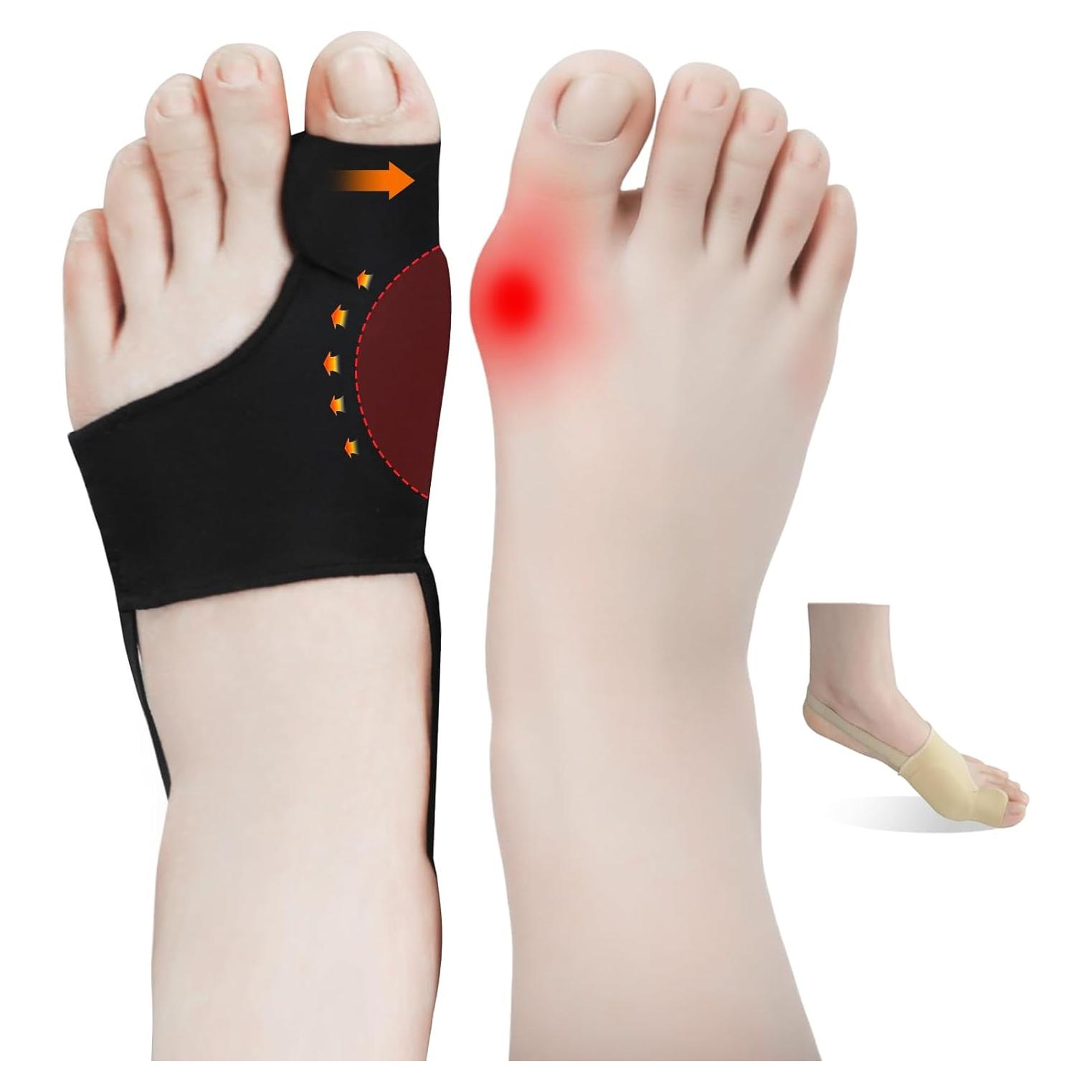 4 Piezas Corrector de Juanetes Perusiaw Alivio Dolor Transpirable