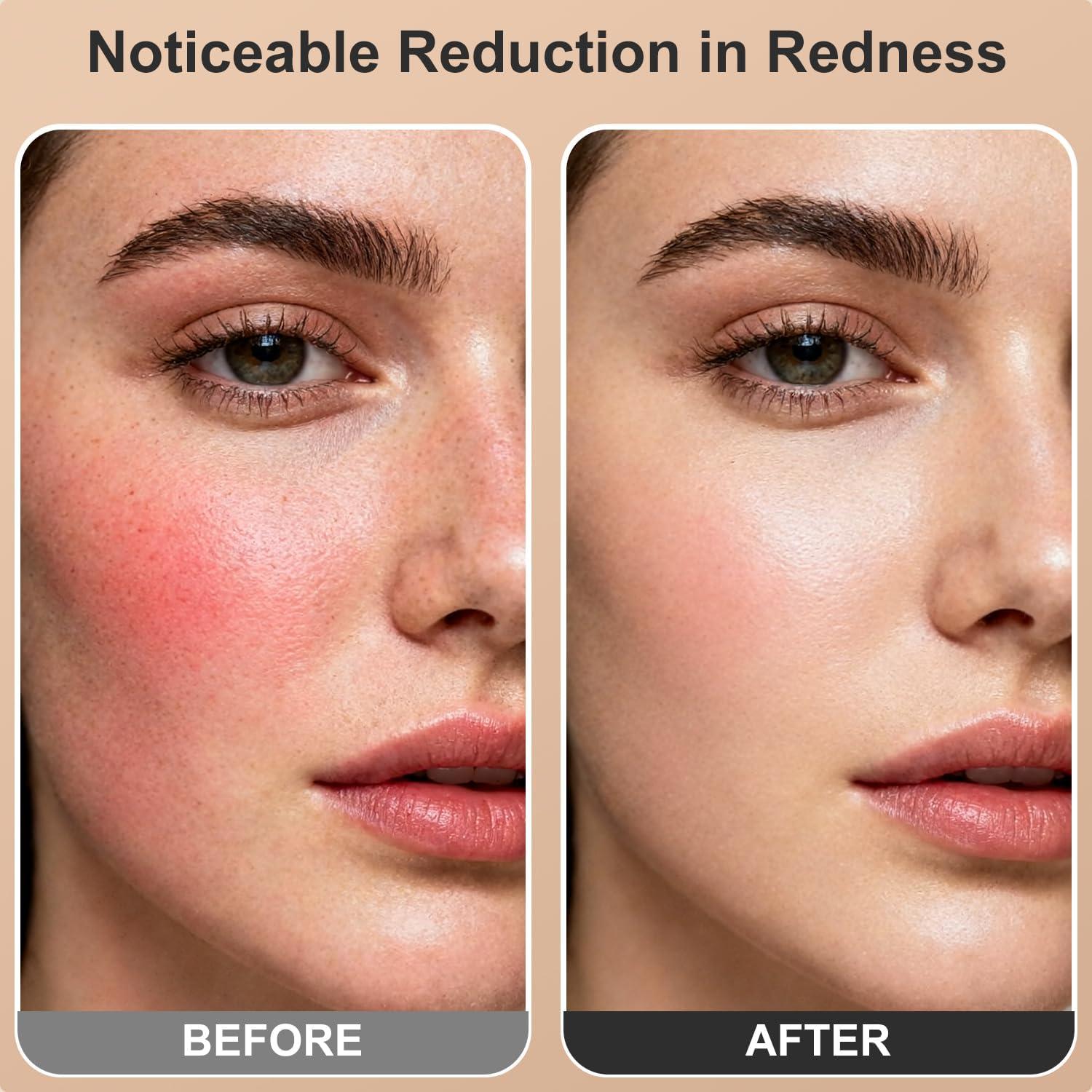 Panel de Terapia de Luz Roja Ziptly 660nm 850nm Ajustable