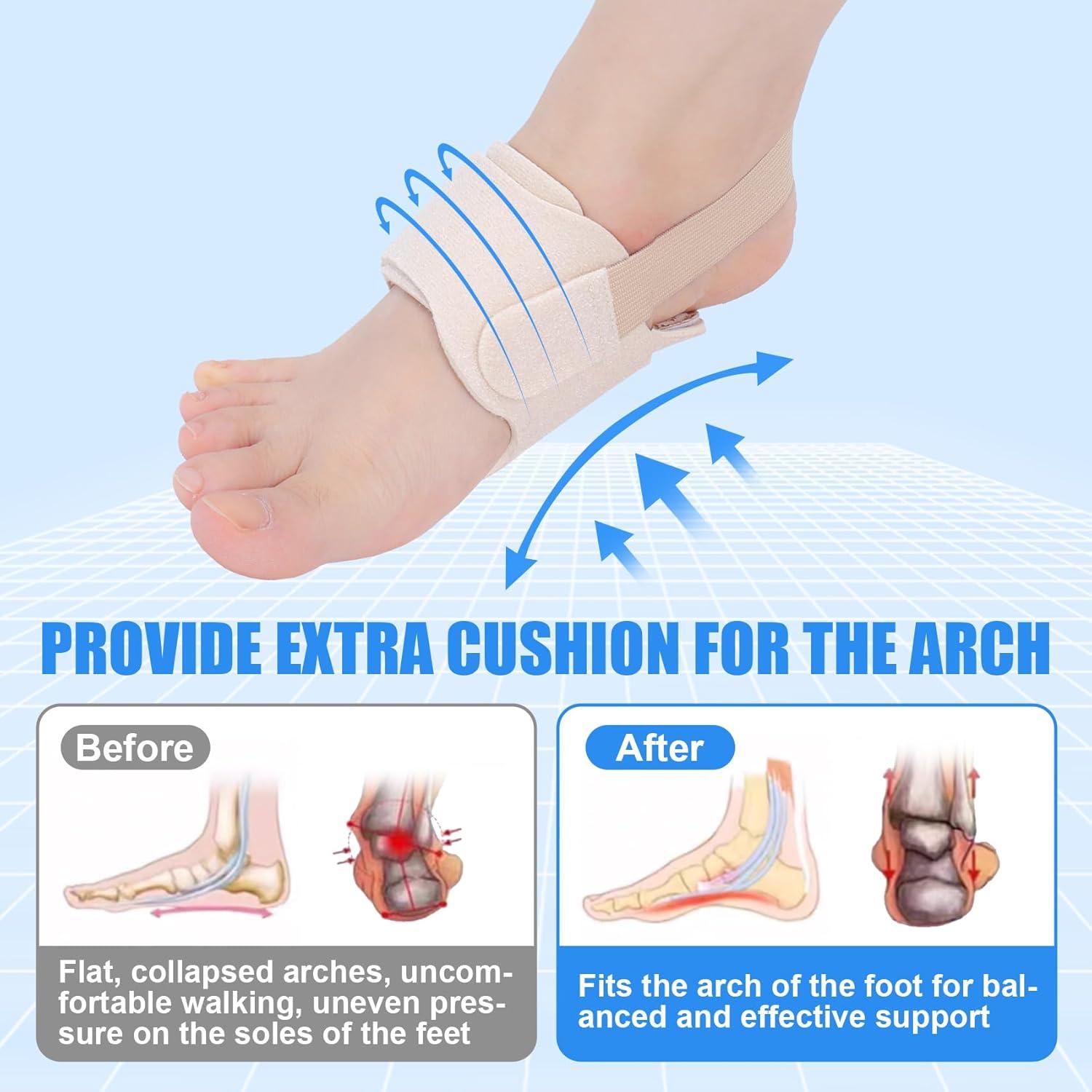 Férulas de Soporte de Arco Vigorwise para Pie Plano - 1 Par Beige