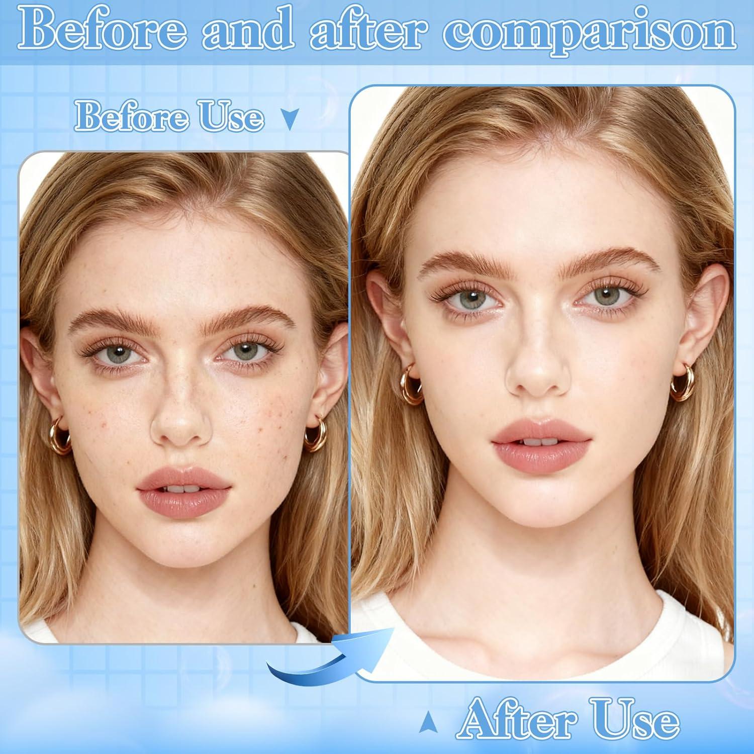 Kit de Herramientas para Extracción de Puntos Negros HairChrysm 9 Piezas