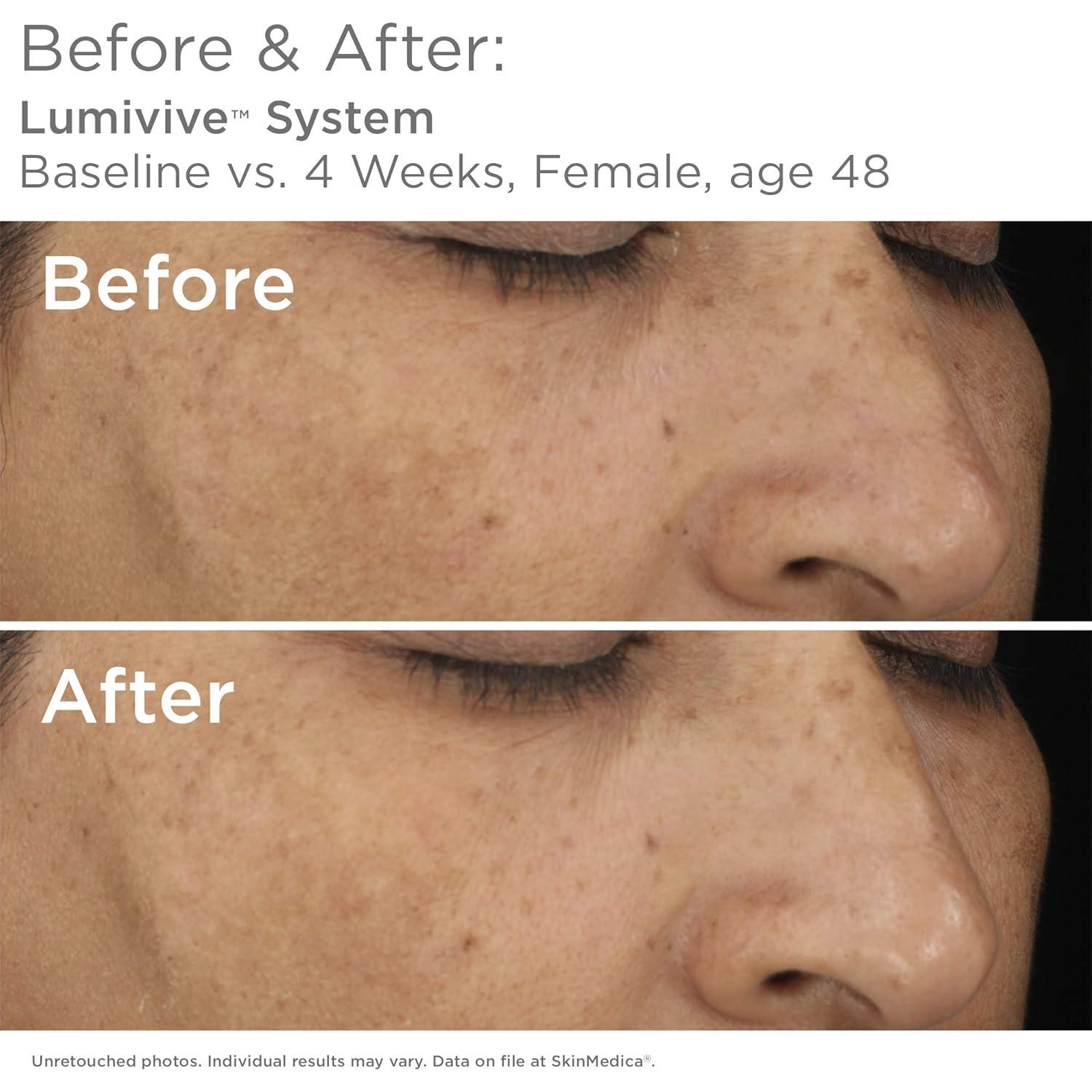 SkinMedica Lumivive Sistema Día y Noche Antienvejecimiento