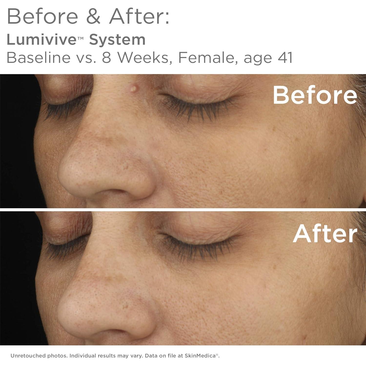 SkinMedica Lumivive Sistema Día y Noche Antienvejecimiento