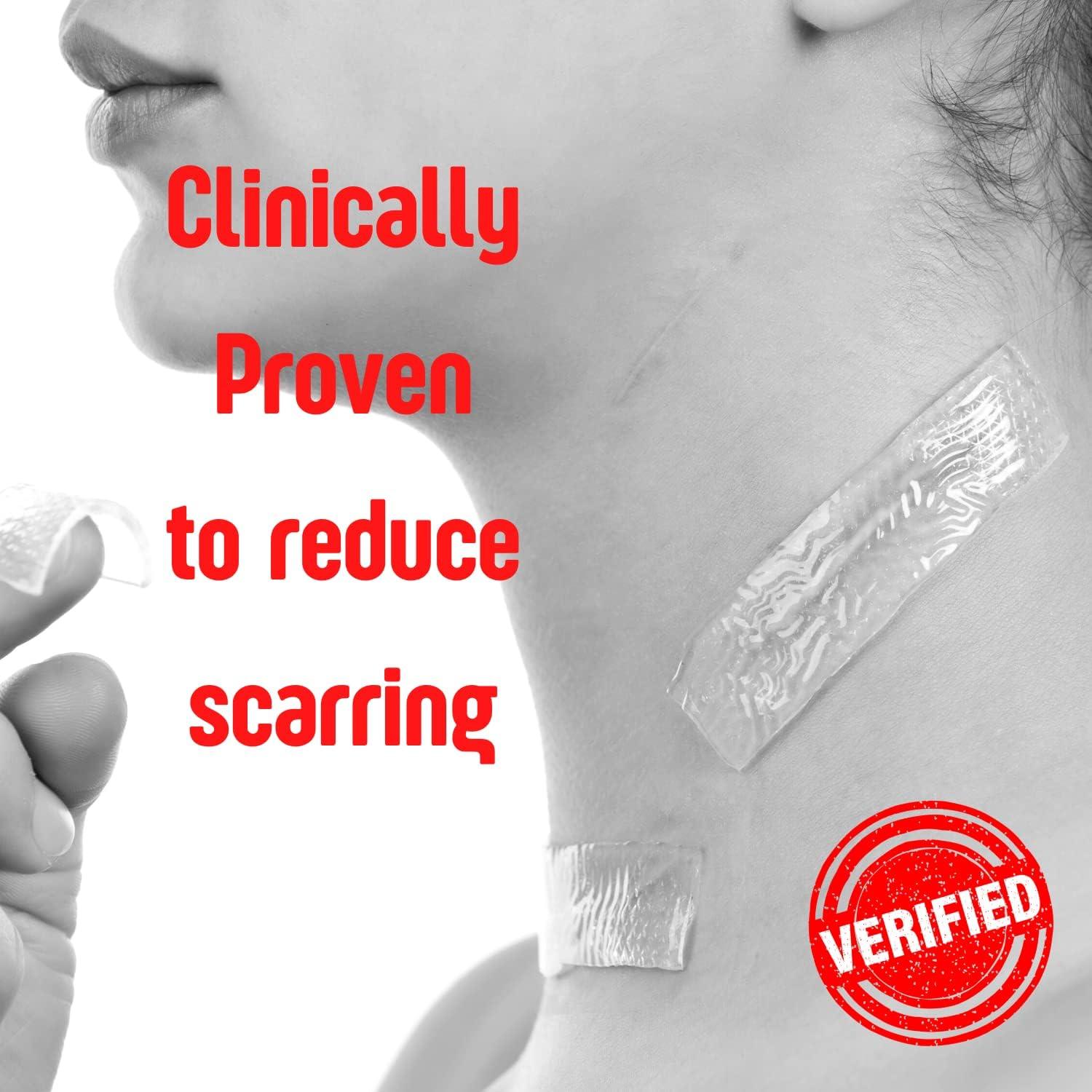 Vendas de Hidrogel SilverSeal 5.08x7.62 cm, 6 unidades