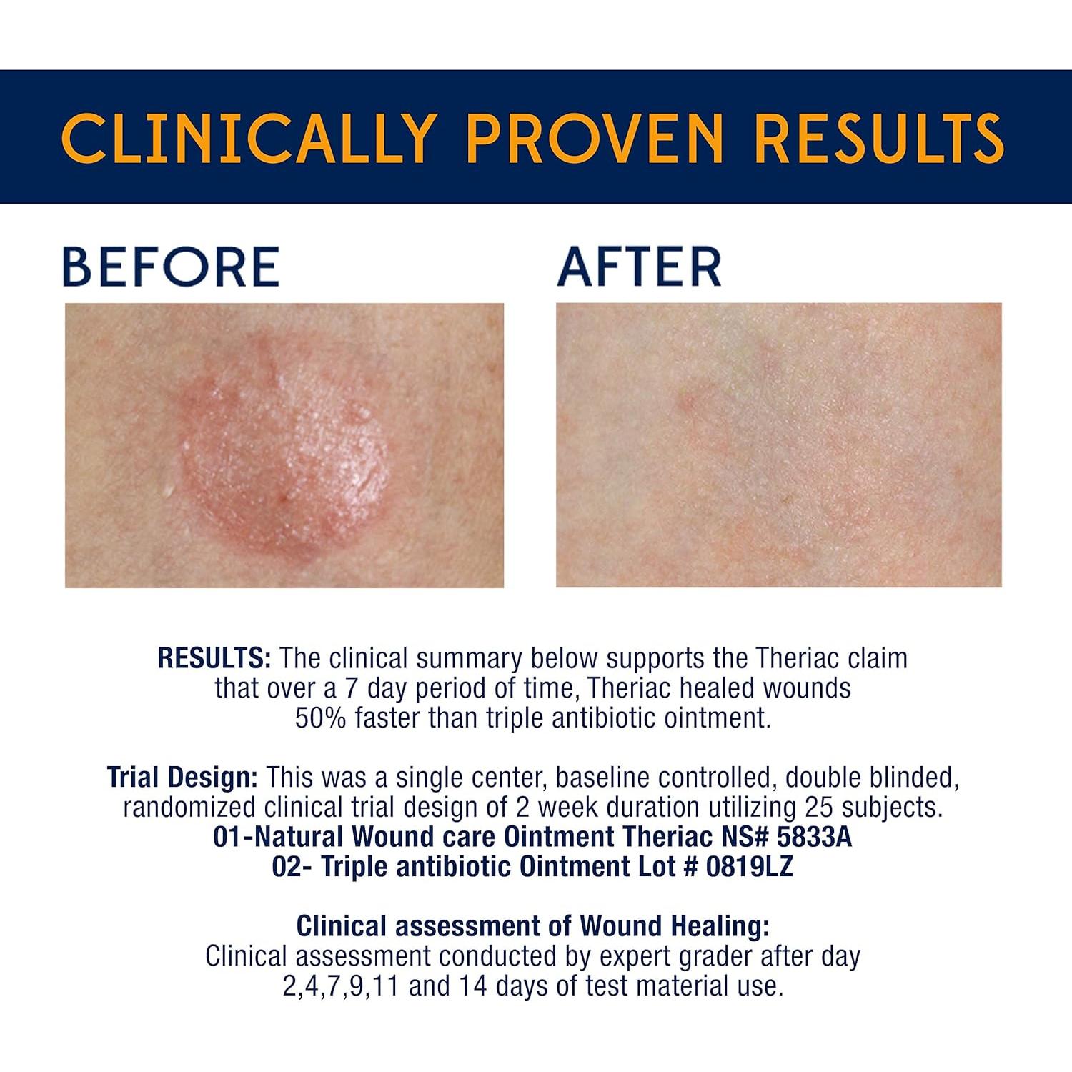 Ungüento Sanador Avanzado Theriac Miel de Manuka 14.17 g - Cura Rápida