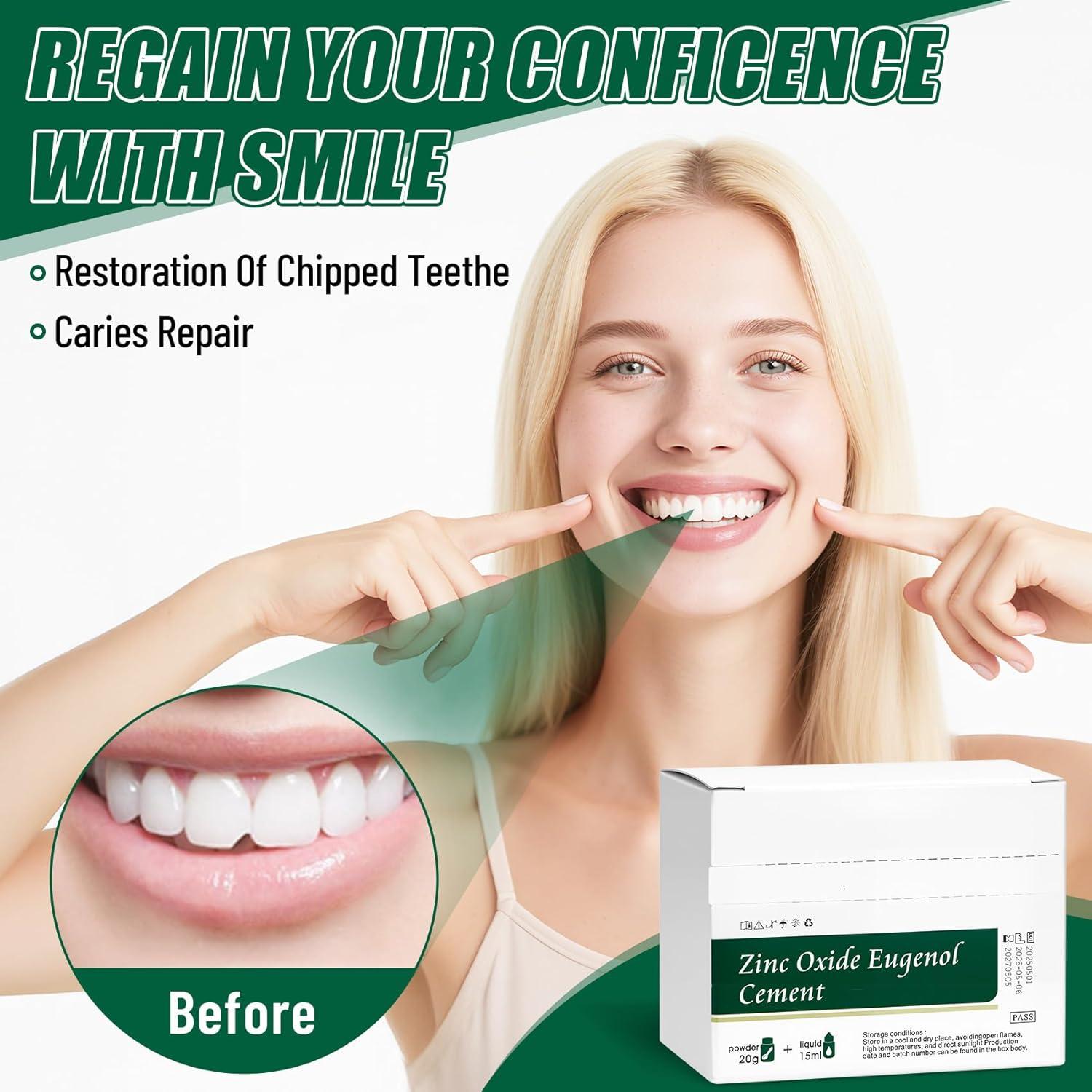 Kit de Cemento Dental Temporal Genérico para Coronas y Puentes