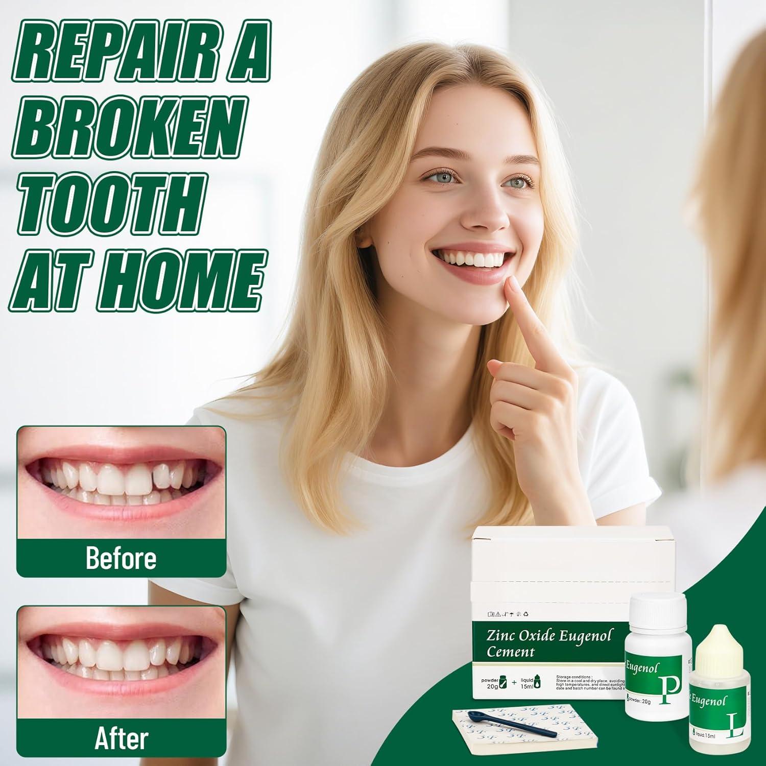 Kit de Cemento Dental Temporal Genérico para Coronas y Puentes