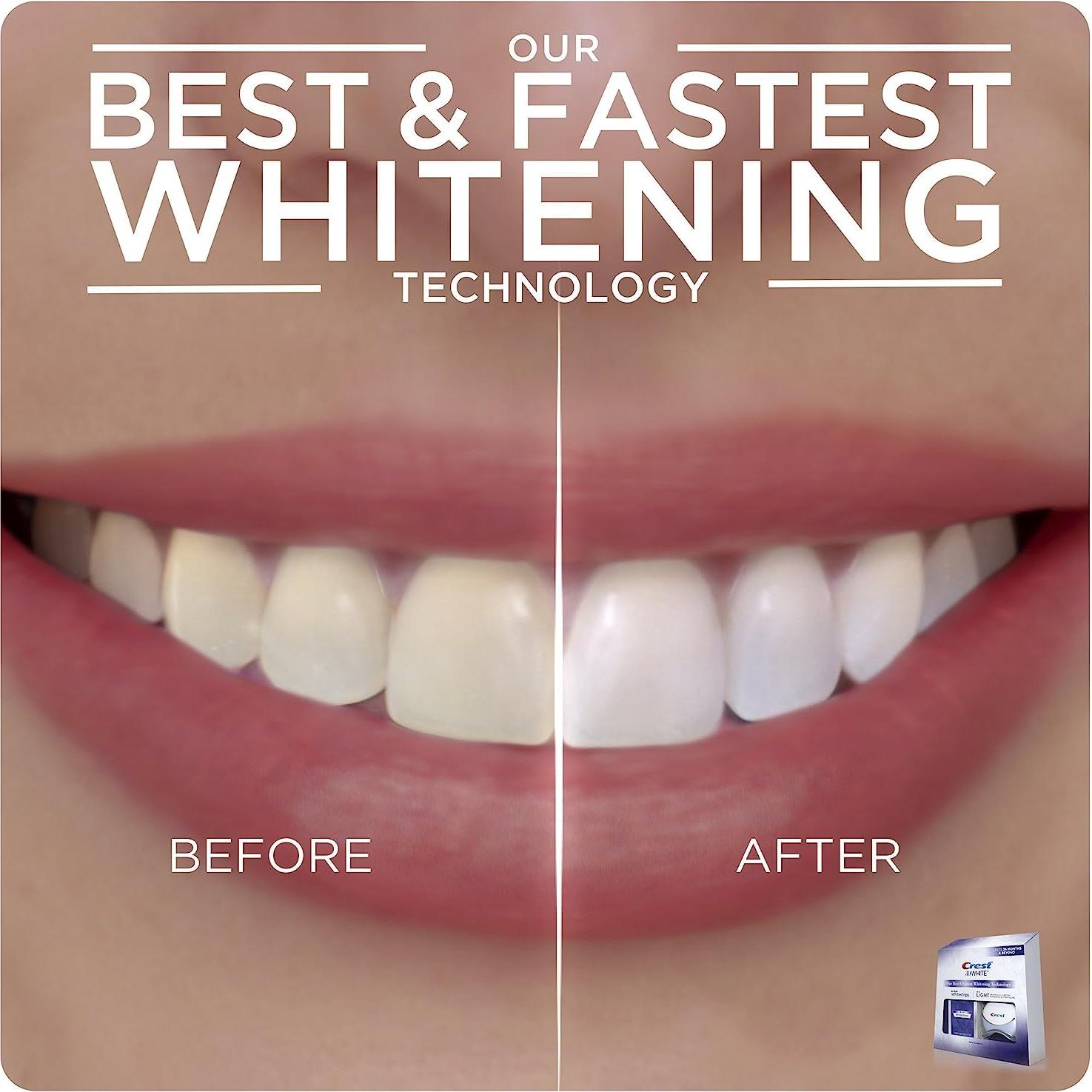 Crest 3D Whitestrips con Luz - Kit Blanqueador Dental 10 Tiras