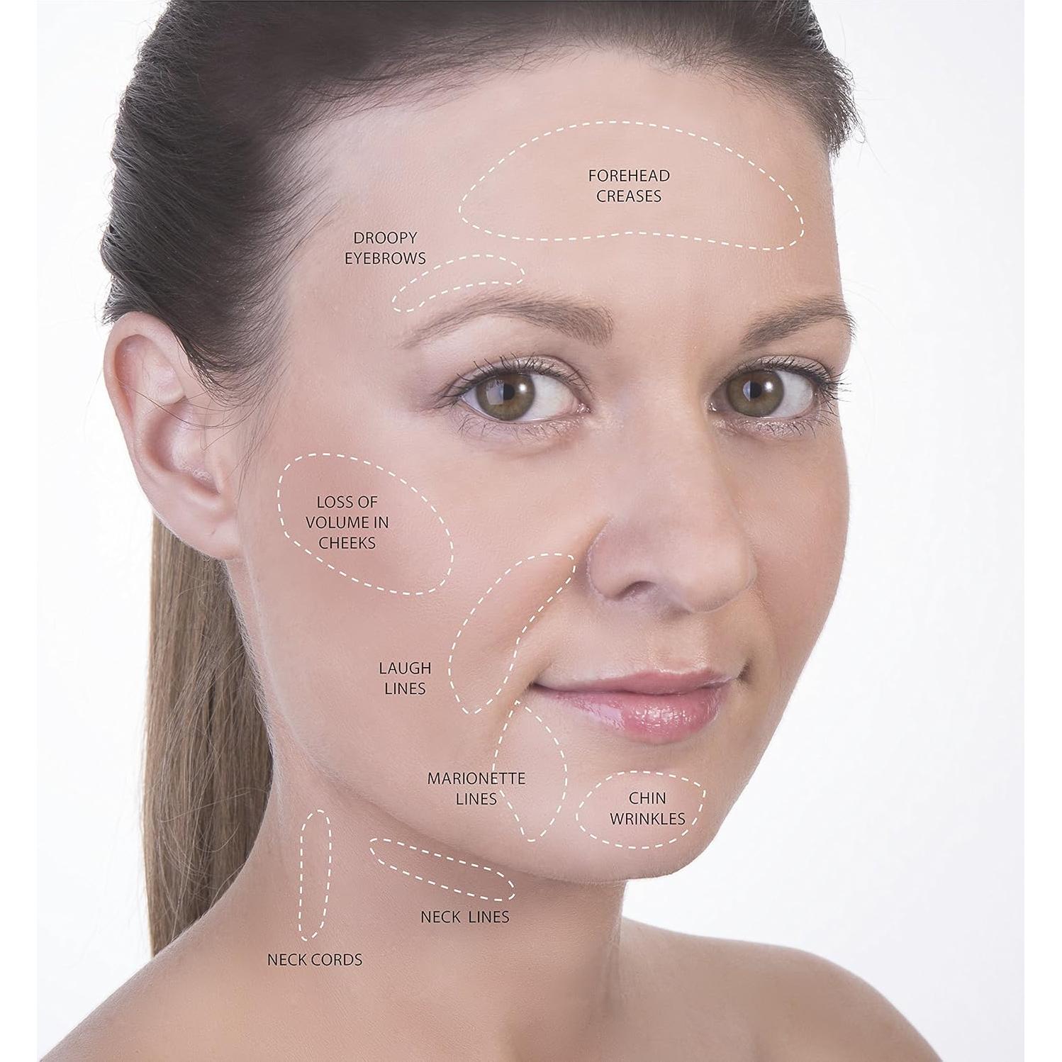 Kit de Ventosas Faciales SanDine - 5 Copas de Silicona