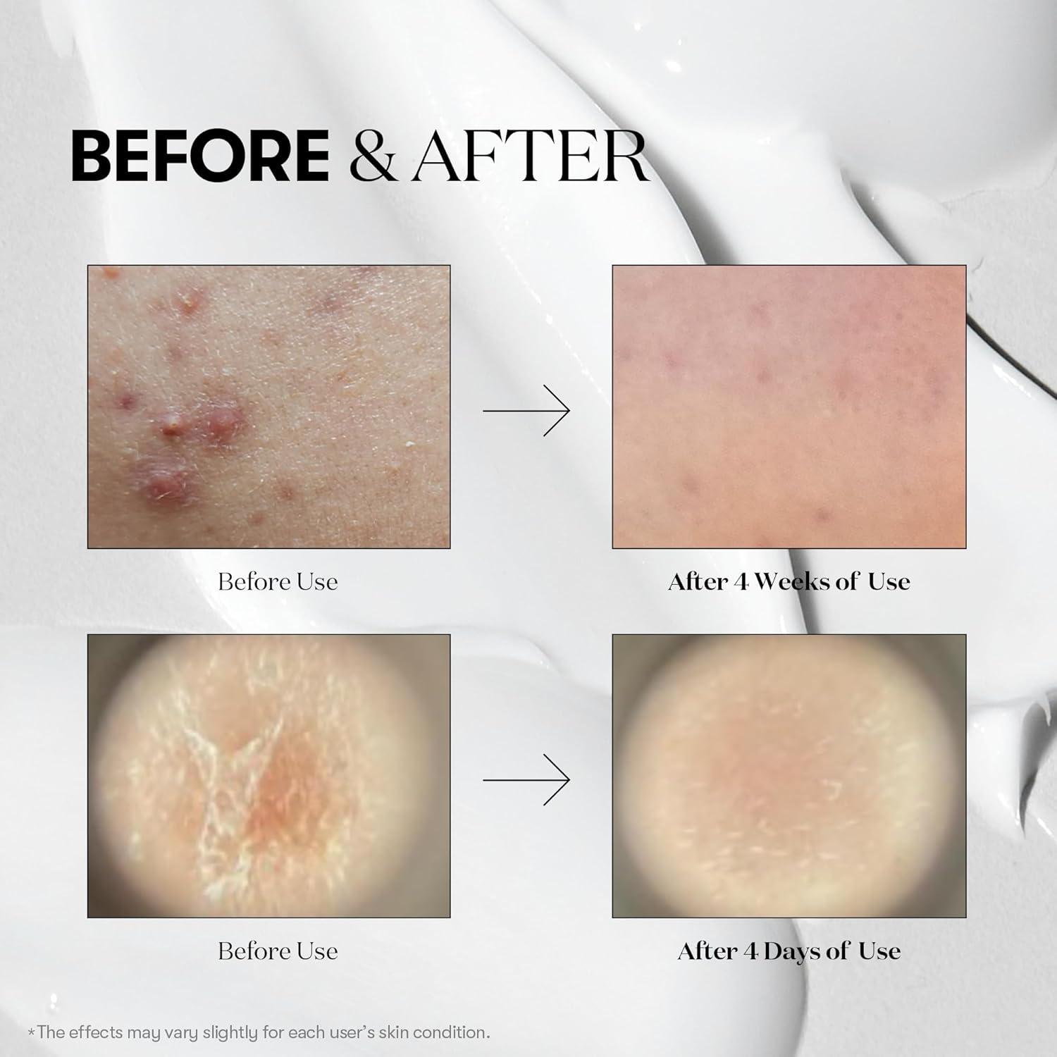 Suero Microneedling VT COSMETICS Reedle Shot 100ml - Cuidado Piel