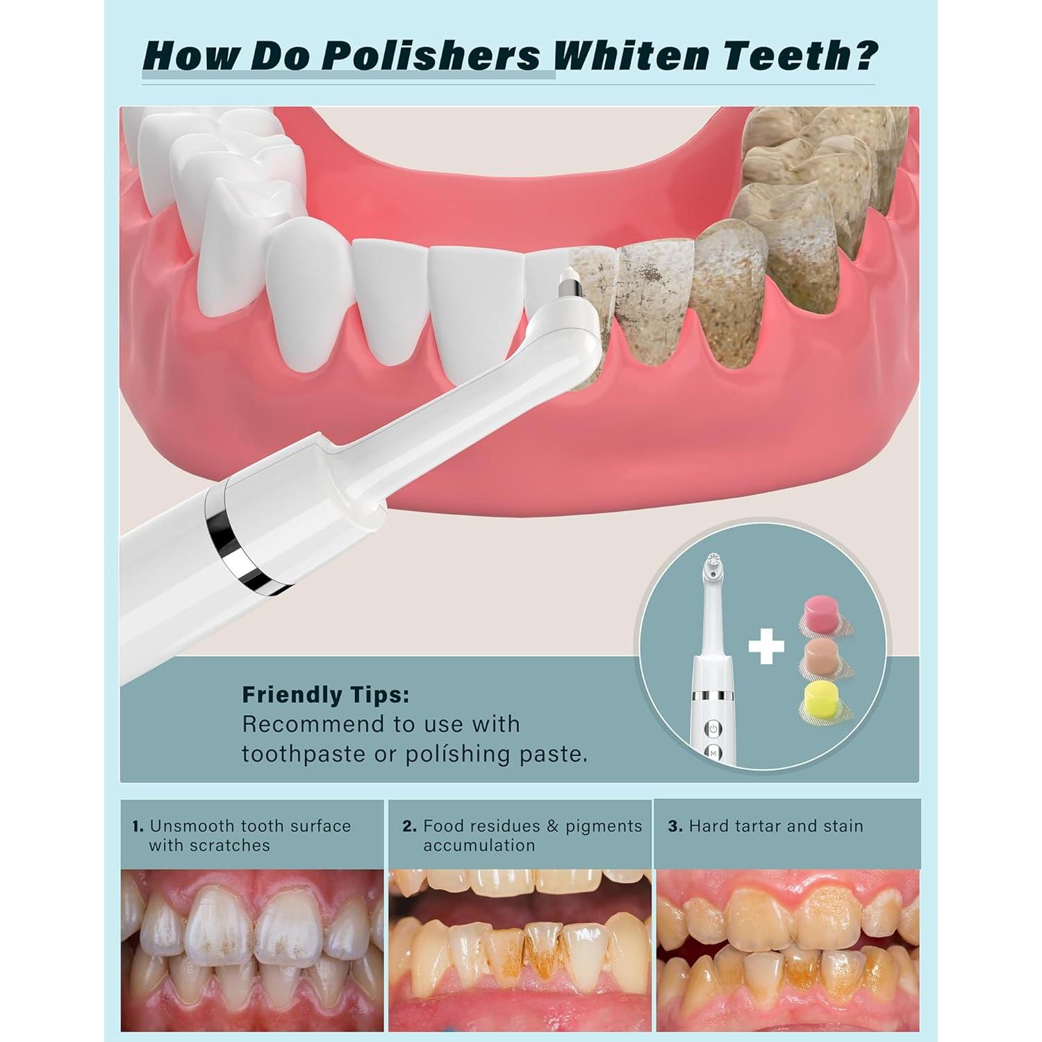 Pulidor Dental Eléctrico Zahnheld WD-JY-A02 con 5 Cabezas