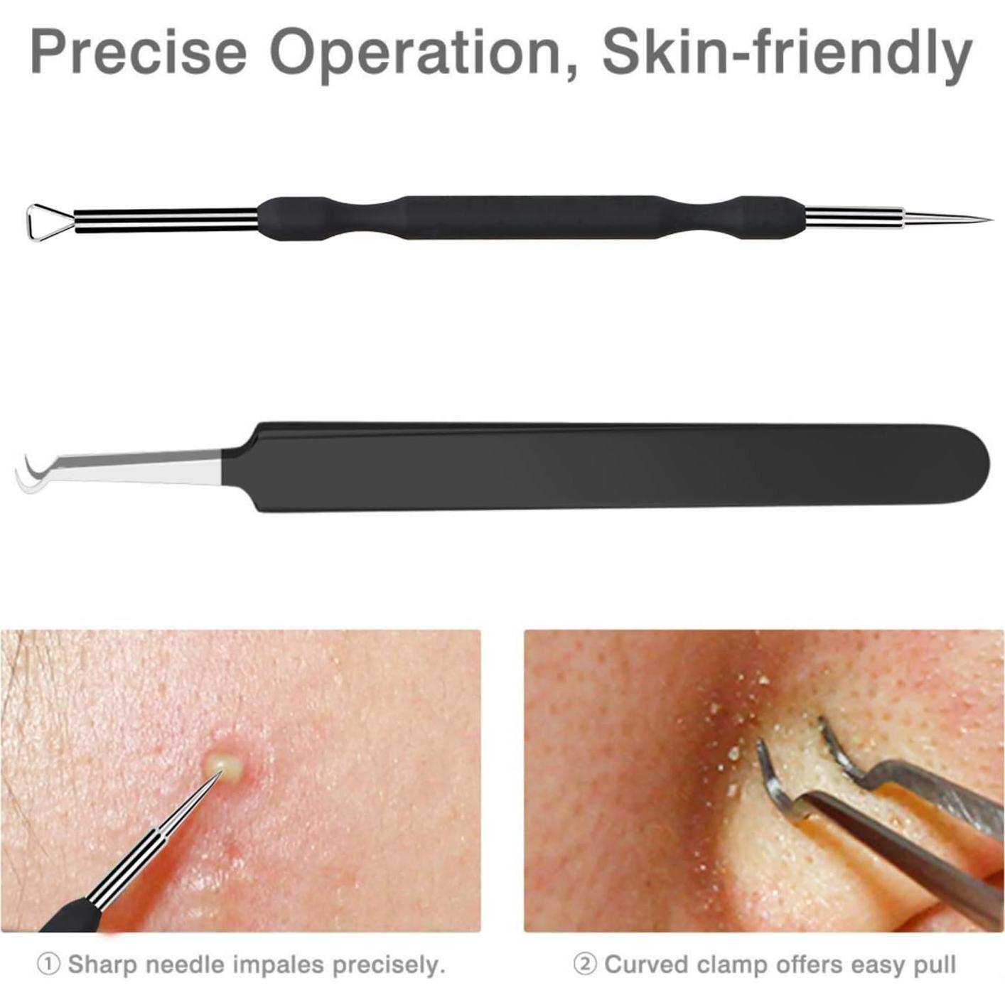 Kit de Extracción de Puntos Negros JPNK 6 Piezas Acero Inoxidable