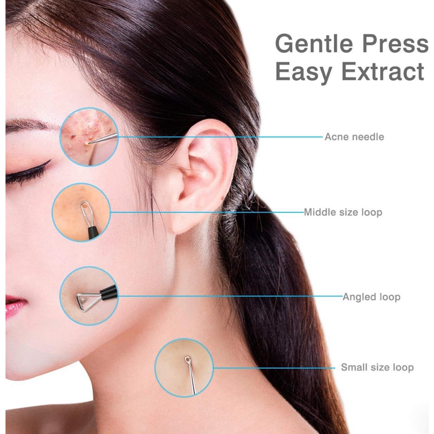 Kit de Extracción de Puntos Negros JPNK 6 Piezas Acero Inoxidable