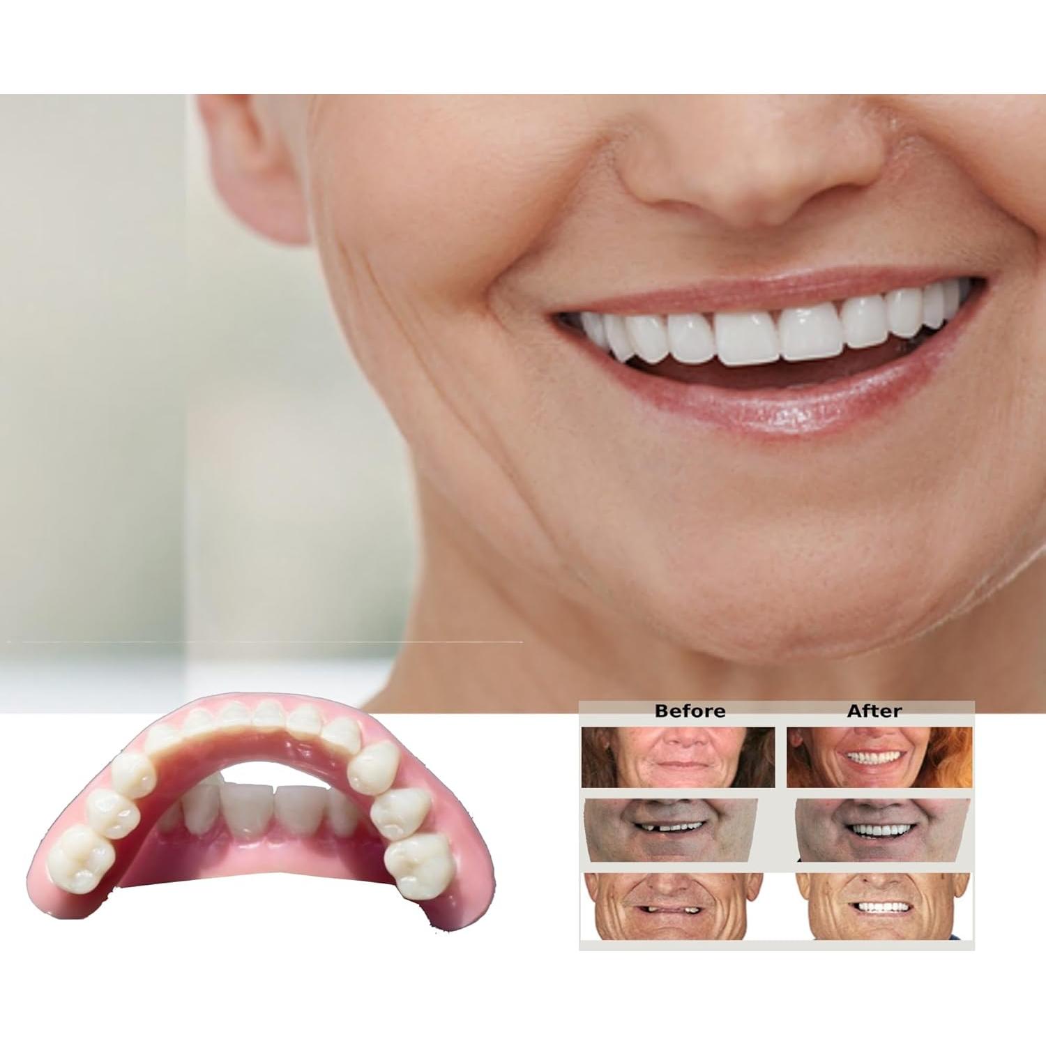 Kit de Dentaduras DIY DENTUREWAY - 56 Dientes Naturales