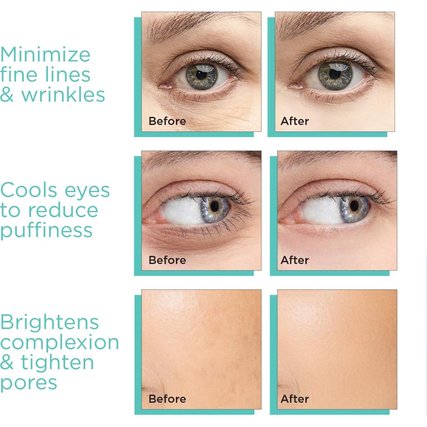 Esferas de Hielo MonétBeauty para Facial - Vidrio Azul 4 Piezas