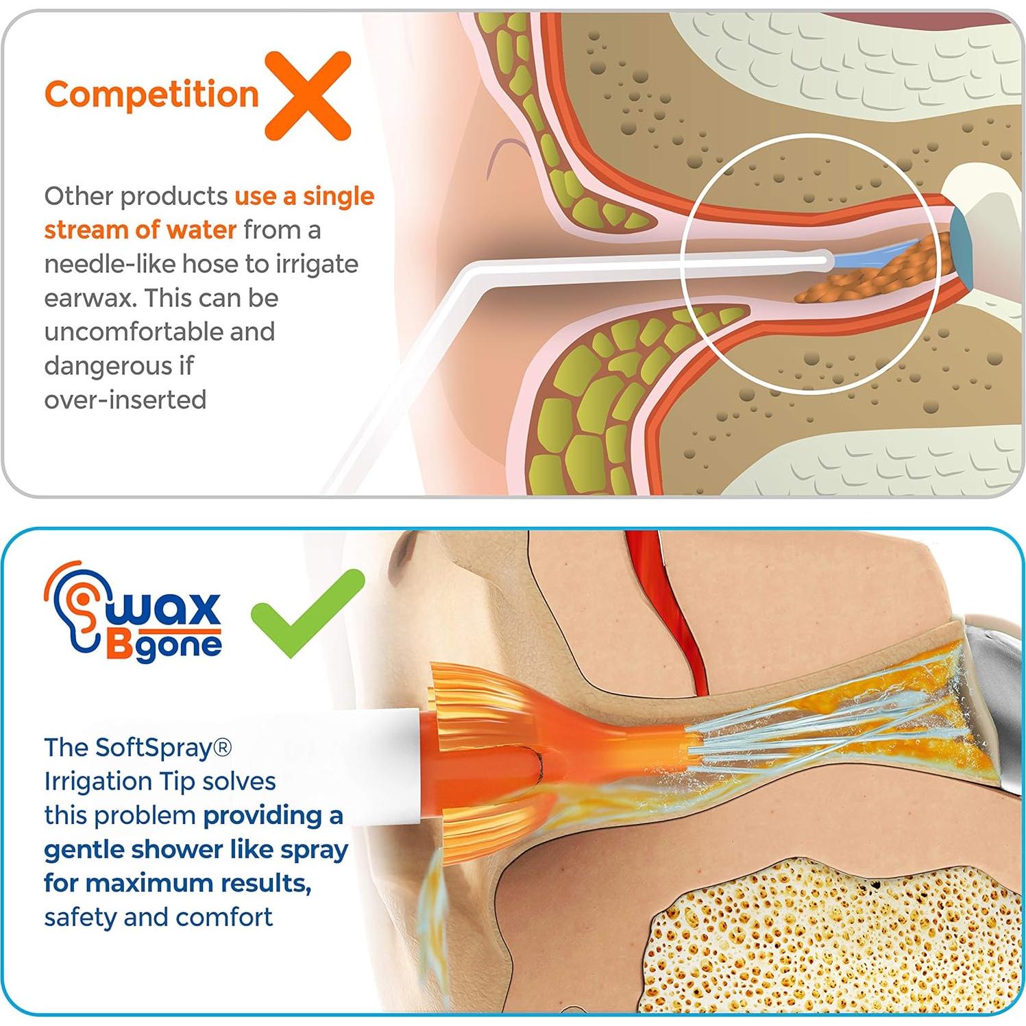 Kit de Eliminación de Cerumen WaxBgone - Irrigación Efectiva
