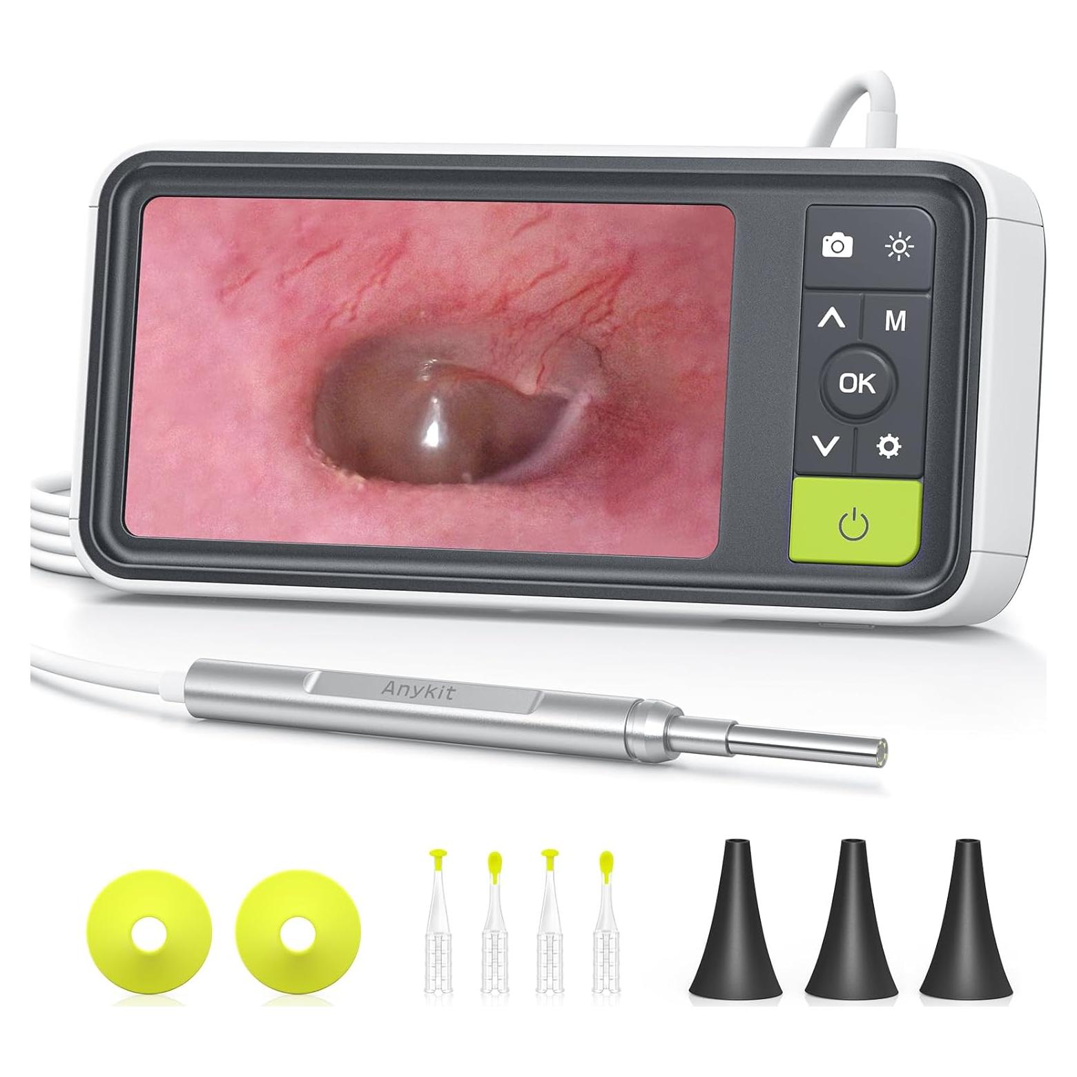 Otoscopio Digital Anykit AKS450 4.5" Pantalla HD 3.9mm