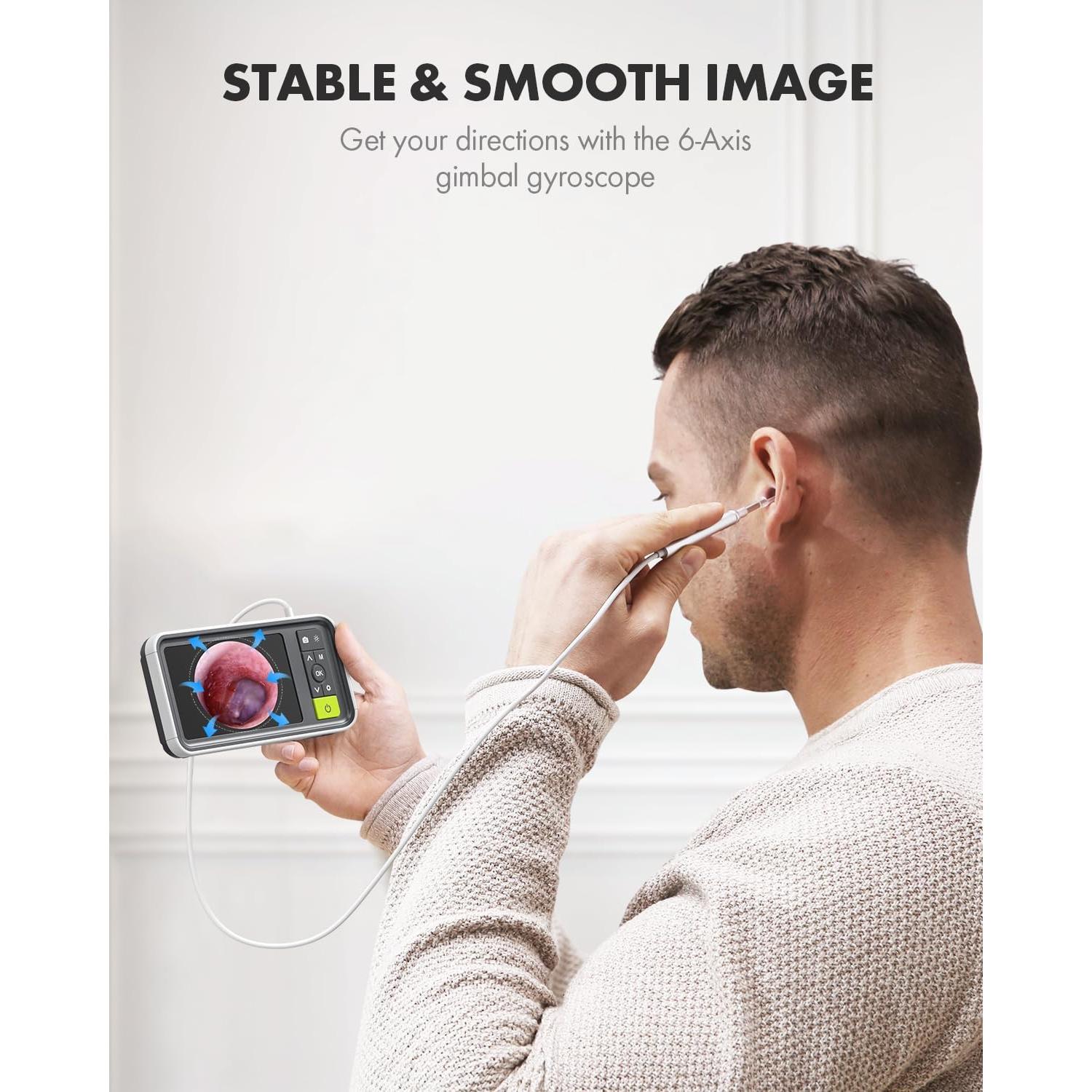 Otoscopio Digital Anykit AKS450 4.5" Pantalla HD 3.9mm