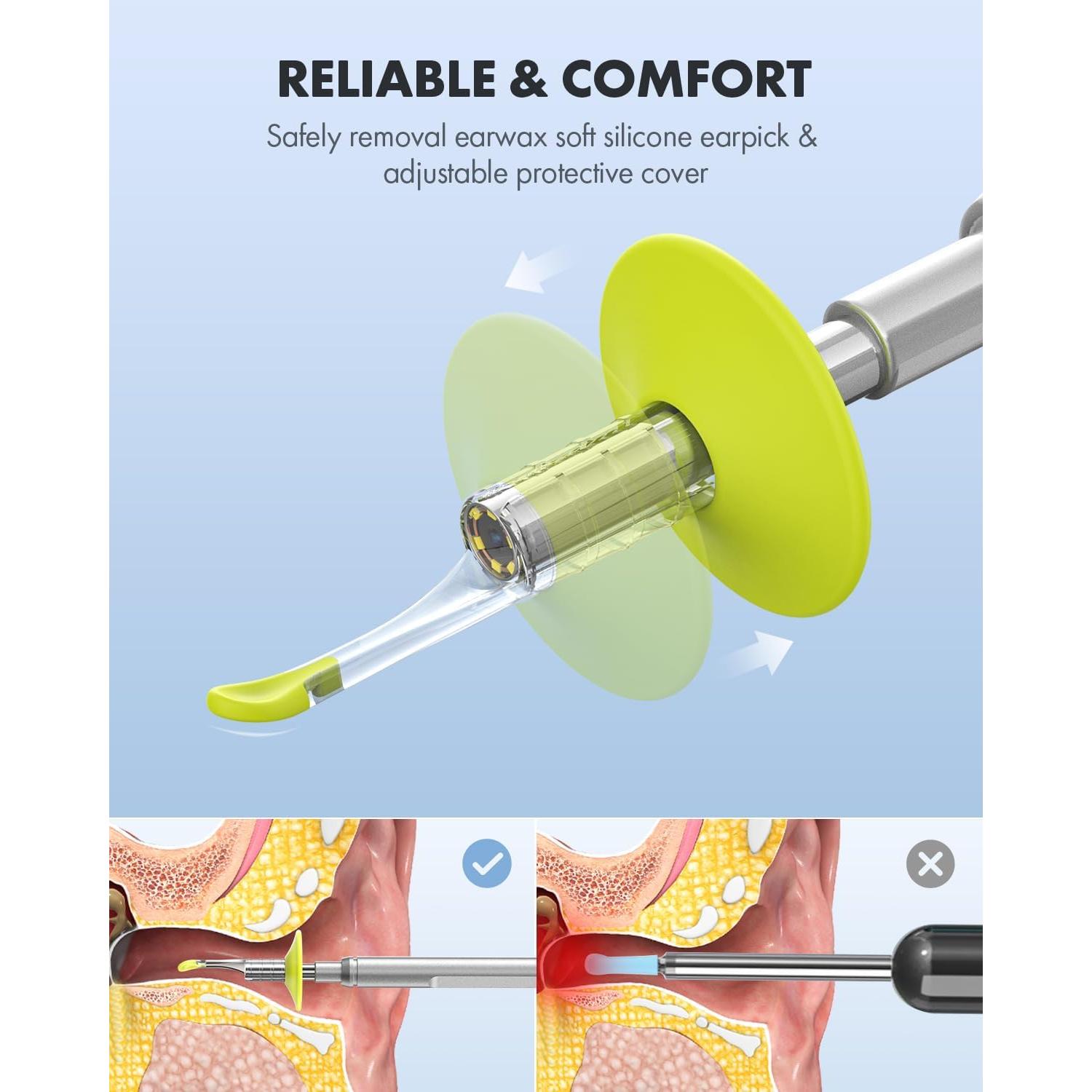 Otoscopio Digital Anykit AKS450 4.5" Pantalla HD 3.9mm