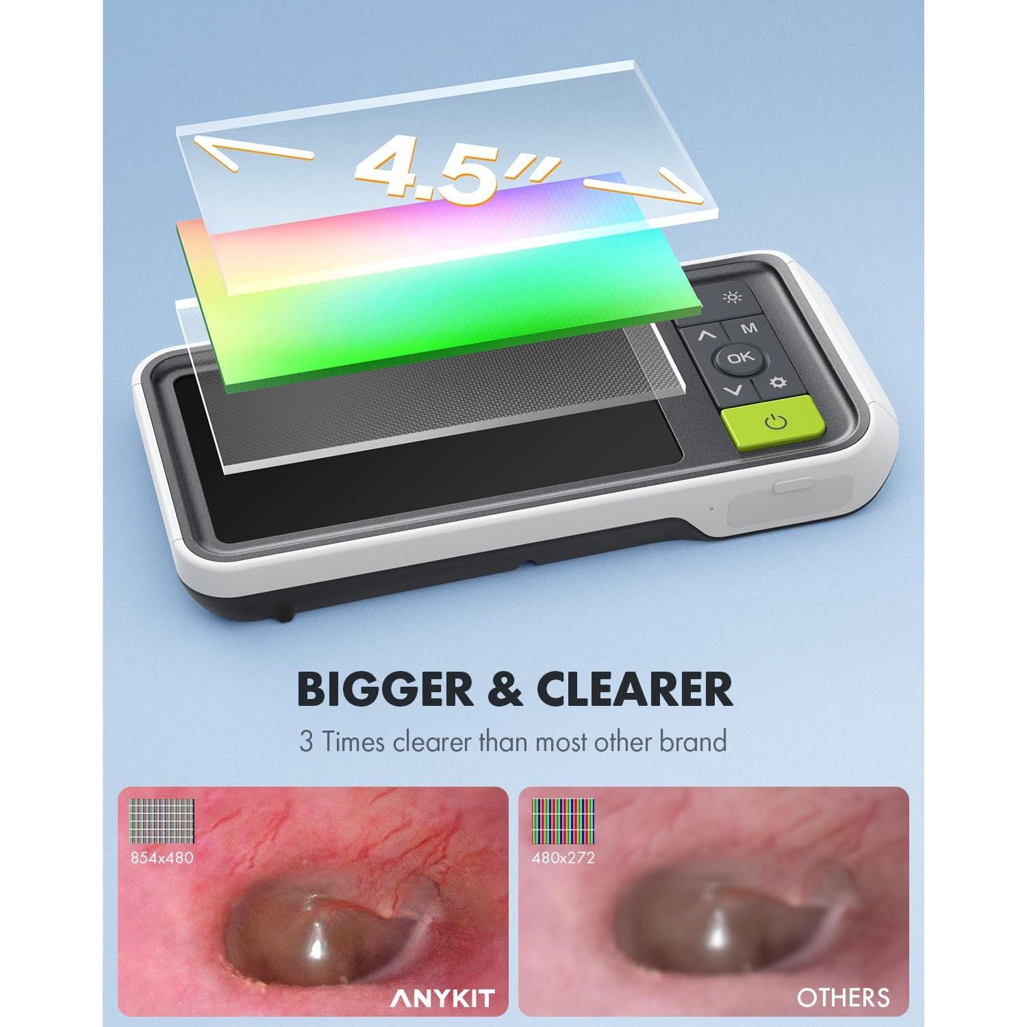 Otoscopio Digital Anykit AKS450 4.5" Pantalla HD 3.9mm