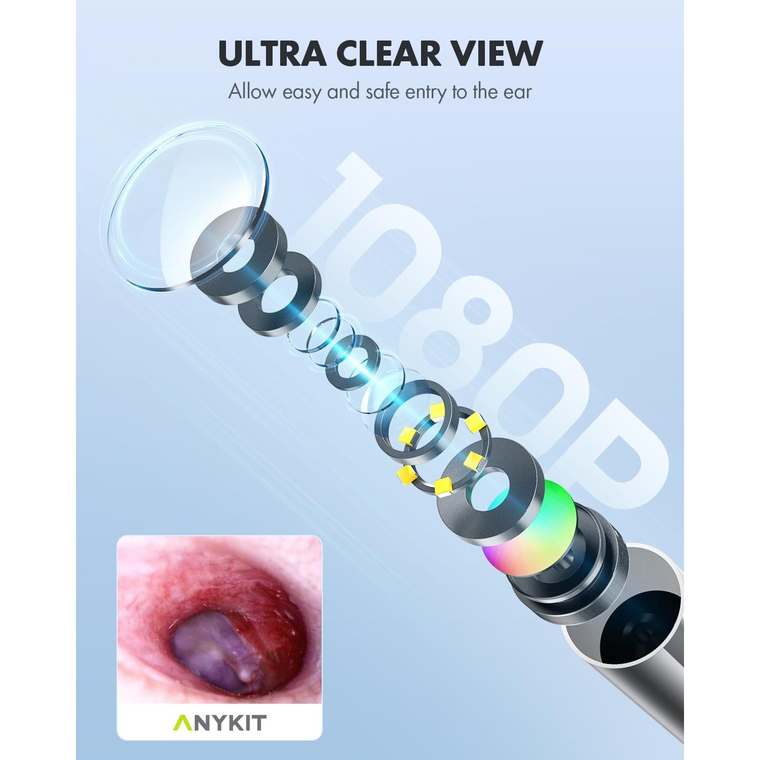 Otoscopio Digital Anykit AKS450 4.5" Pantalla HD 3.9mm