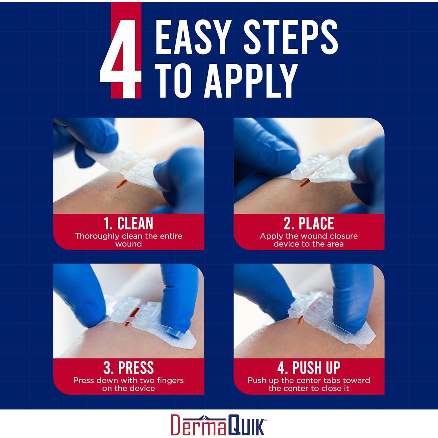 Kit de Cierre de Laceraciones DermaQuik - 2 Tiras Transpirables