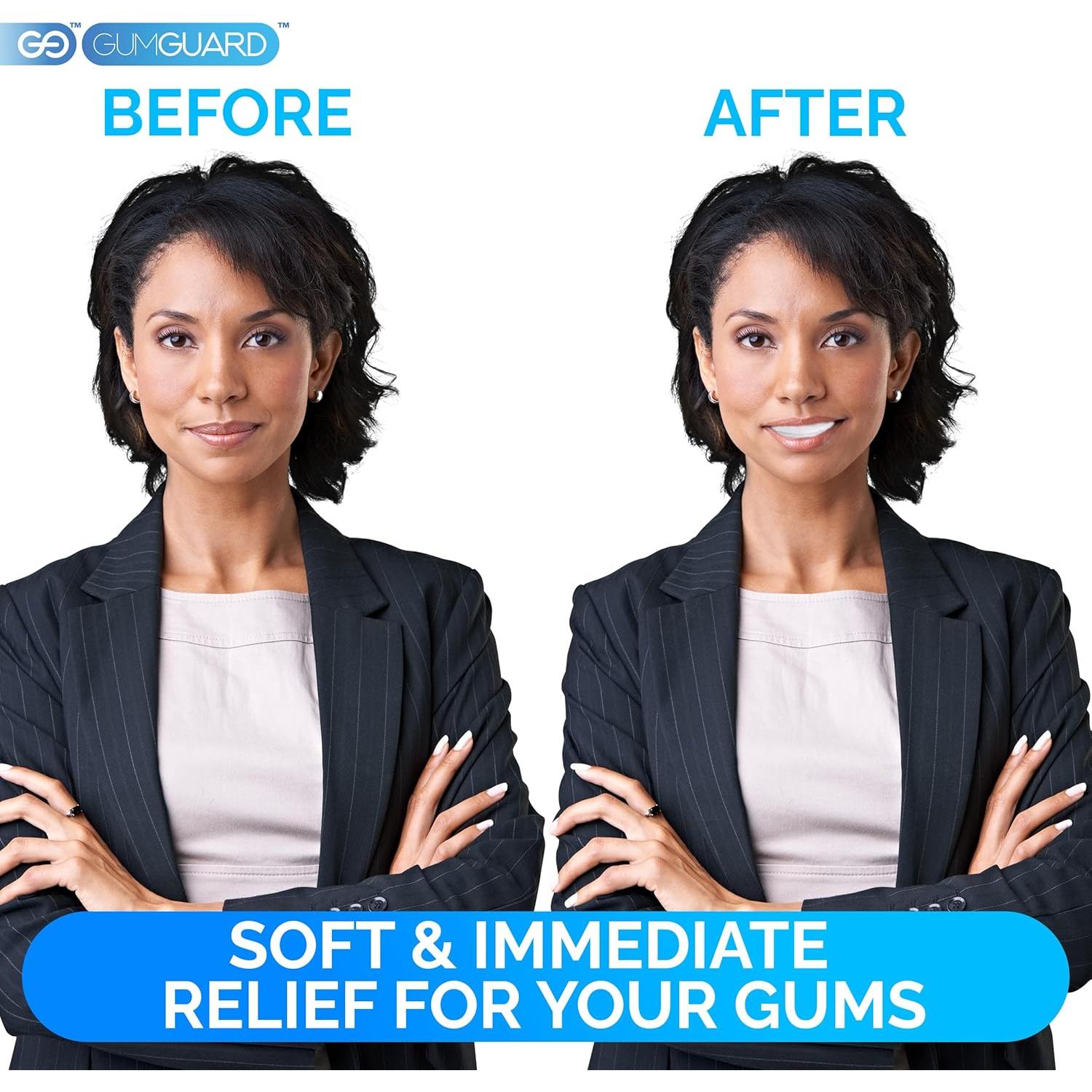 Masilla para Dentaduras GumGuard 2 Paquete Ajuste Rápido