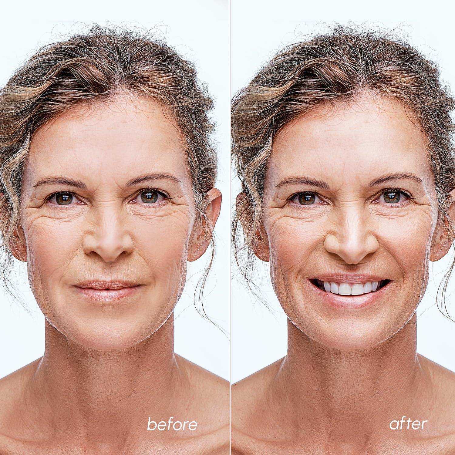 Almohadillas de Tónico para Imperfecciones Maree - 255g