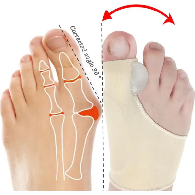 PEXERA Bunion Corrector Splint, 2 Pack, Toe Separator and Silicone Protector for Hallux Valgus, Foot Slip-On (Beige)