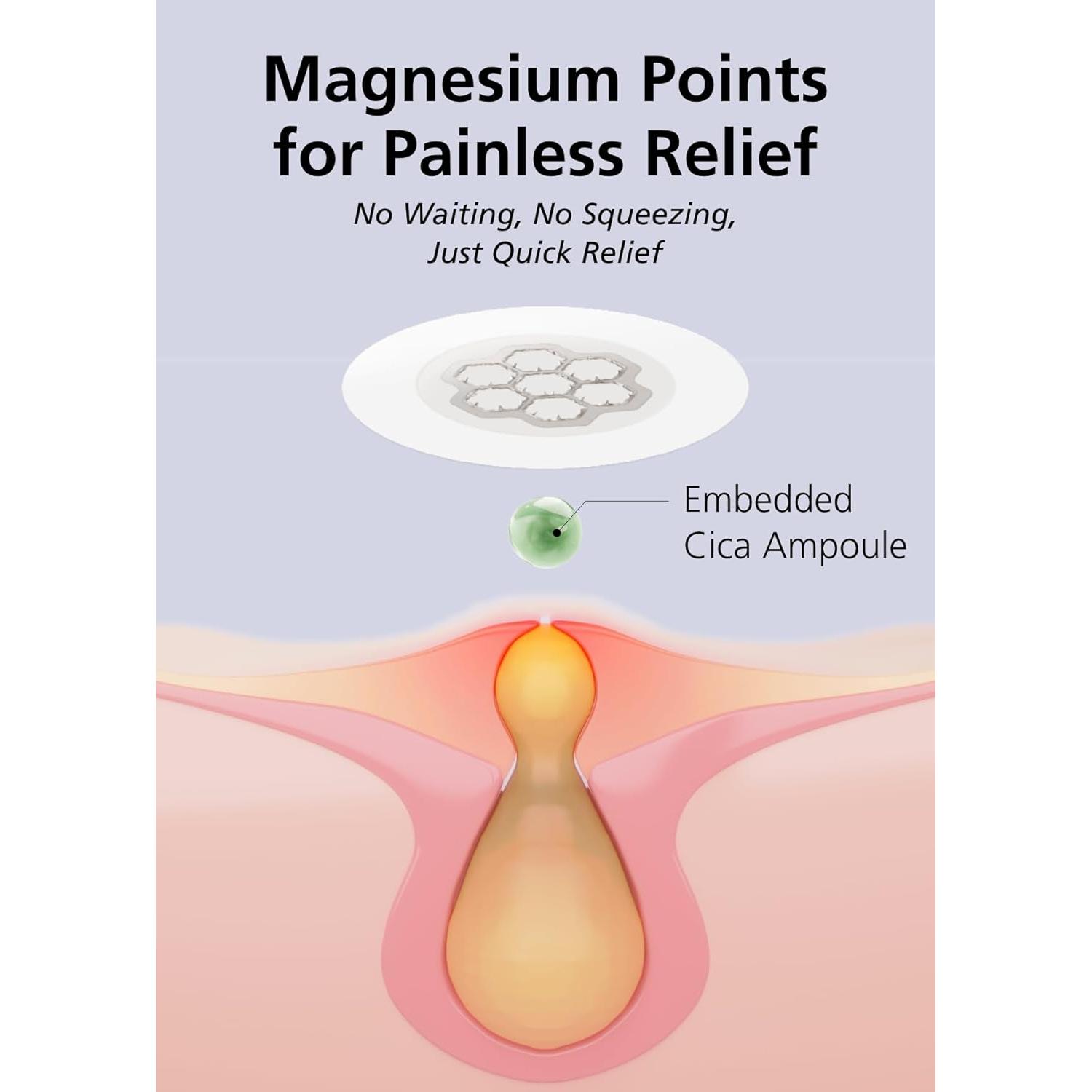 EasyDerm Parches Calmantes de Magnesio - 30 Parches Individuales