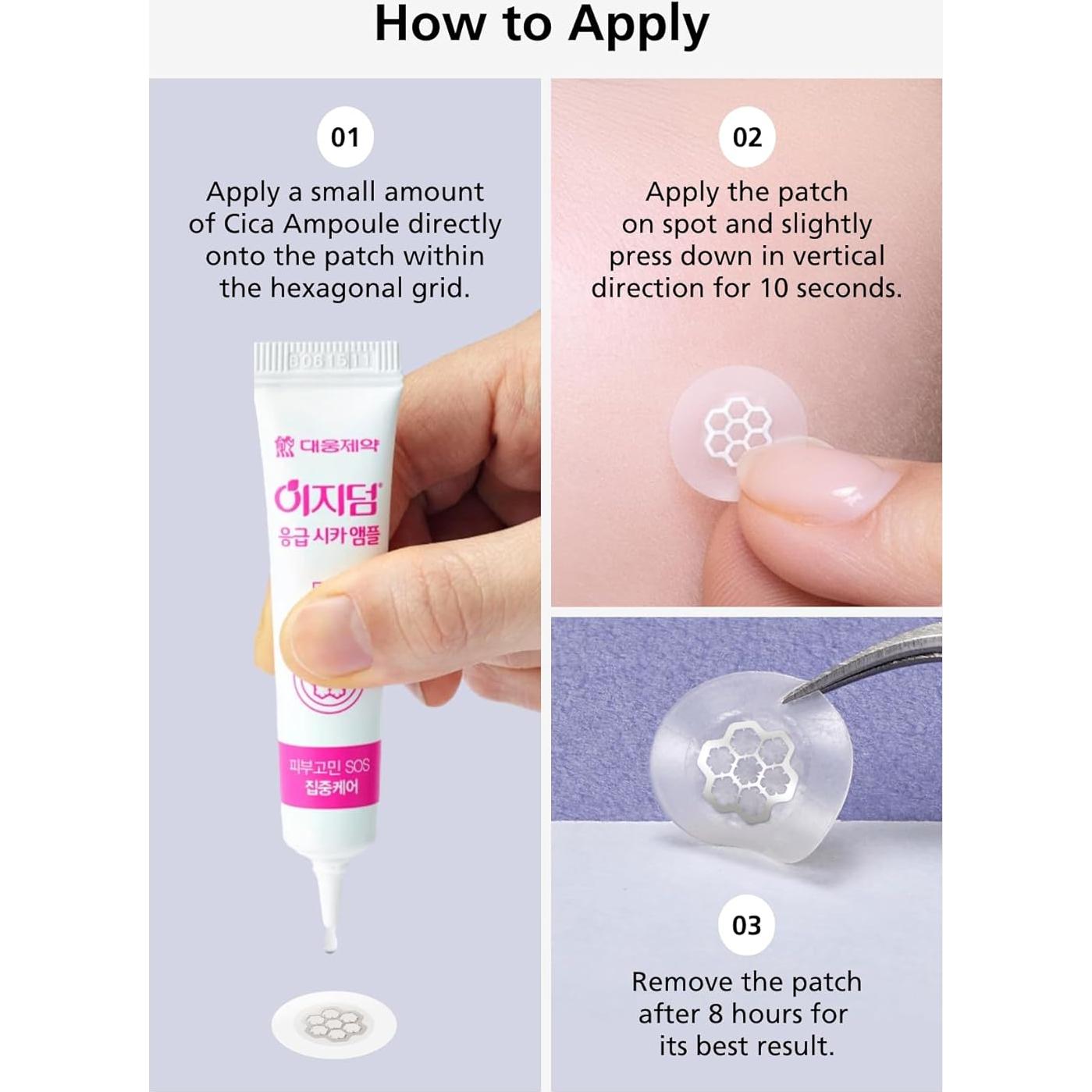 EasyDerm Parches Calmantes de Magnesio - 30 Parches Individuales